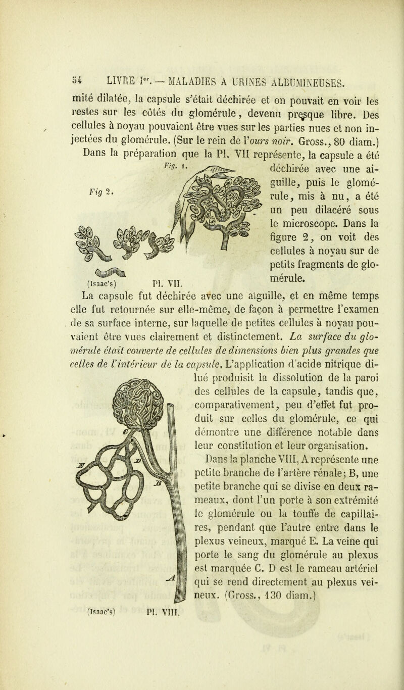 mité dilatée, la capsule s'était déchirée et on pouvait en voir les restes sur les côtés du glomérule , devenu presque libre. Des cellules à noyau pouvaient être vues sur les parties nues et non in- jectées du glomérule. (Sur le rein de Yours noir. Gross., 80 diam.) Dans la préparation que la PL VII représente, la capsule a été déchirée avec une ai- guille, puis le glomé- rule, mis à nu, a été un peu dilacéré sous le microscope. Dans la figure 2, on voit des cellules à noyau sur de petits fragments de glo- (isaac's) Pl. VII. mérule' La capsule fut déchirée avec une aiguille, et en même temps elle fut retournée sur elle-même, de façon à permettre l'examen de sa surface interne, sur laquelle de petites cellules à noyau pou- vaient être vues clairement et distinctement. La surface du glo- mérule était couverte de cellules de dimensions bien plus grandes que celles de l'intérieur de la capsule. L'application d'acide nitrique di- lué produisit la dissolution de la paroi des cellules de la capsule, tandis que, comparativement, peu d'effet fut pro- duit sur celles du glomérule, ce qui démontre une différence notable dans leur constitution et leur organisation. Dans la planche VIII, A représente une petite branche de l'artère rénale; B, une petite branche qui se divise en deux ra- meaux, dont l'un porte à son extrémité le glomérule ou la touffe de capillai- res, pendant que l'autre entre dans le plexus veineux, marqué E. La veine qui porte le sang du glomérule au plexus est marquée C. D est le rameau artériel qui se rend directement au plexus vei- neux. (Gross., 130 diam.)
