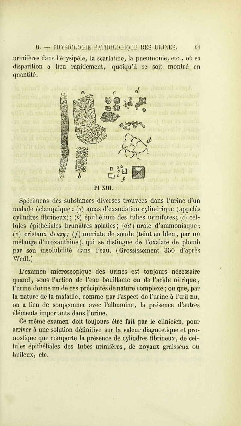 urinifères dans Férysipèle, la scarlatine, la pneumonie, etc. , où sa disparition a lieu rapidement, quoiqu'il se soit montré en quantité. Spécimens des substances diverses trouvées dans l'urine d'un malade éclamptique : (a) amas d'exsudation cylindrique (appelés cylindres tibrineux); (b) épithélium des tubes urinifères; (c) cel- lules épithéliales brunâtres aplaties; (dd) urate d'ammoniaque; (e) cristaux drusy; (/) muriate de soude (teint en bleu, par un mélange d'uroxanthine ), qui se distingue de l'oxalate de plomb par son insolubilité dans l'eau. (Grossissement 350 d'après Wedl.) L'examen microscopique des urines est toujours nécessaire quand, sous l'action de l'eau bouillante ou de l'acide nitrique, l'urine donne un de ces précipités de nature complexe ; ou que, par la nature de la maladie, comme par l'aspect de l'urine à Fœil nu, on a lieu de soupçonner avec l'albumine, la présence d'autres éléments importants dans l'urine. Ce même examen doit toujours être fait par le clinicien, pour arriver à une solution définitive sur la valeur diagnostique et pro- nostique que comporte la présence de cylindres fibrineux, de cel- lules épithéliales des tubes urinifères, de noyaux graisseux ou huileux, etc.