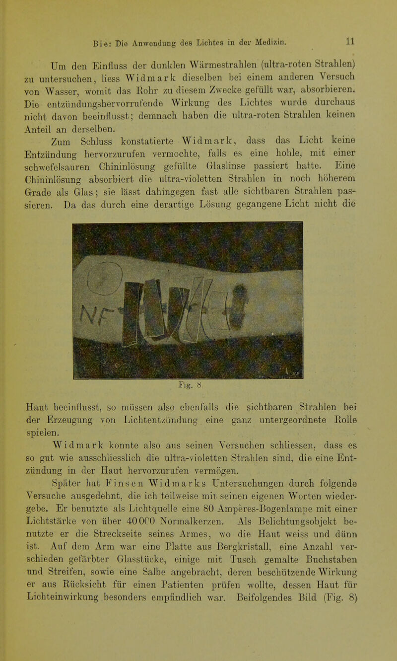 Um den Einfluss der dunklen Wärmestrahlen (ultra-roten Strahlen) zu untersuchen, Hess Widmark dieselben bei einem anderen Versuch von Wasser, Avomit das Rohr zu diesem Zwecke gefüllt war, absorbieren. Die entzündungshervorrufende Wirkung des Lichtes wurde durchaus nicht davon beeinflusst; demnach haben die ultra-roten Strahlen keinen Anteil an derselben. Zum Schluss konstatierte Widmark, dass das Licht keine Entzündung hervorzurufen vermochte, falls es eine hohle, mit einer schwefelsauren Chininlösung gefüllte Glaslinse passiert hatte. Eine Chininlösung absorbiert die ultra-violetten Strahlen in noch höherem Grade als Glas; sie lässt dahingegen fast alle sichtbaren Strahlen pas- sieren. Da das durch eine derartige Lösung gegangene Licht nicht die Fig. «. Haut beeinflusst, so müssen also ebenfalls die sichtbaren Strahlen bei der Erzeugung von Lichtentzündung eine ganz untergeordnete Rolle spielen. Widmark konnte also aus seinen Versuchen schliessen, dass es so gut wie ausschliesslich die ultra-violetten Strahlen sind, die eine Ent- zündung in der Haut hervorzurufen vermögen. Später hat Einsen Widmarks Untersuchungen durch folgende Versuche ausgedehnt, die ich teilweise mit seinen eigenen Worten wieder- gebe. Er benutzte als Lichtquelle eine 80 Amperes-Bogenlampe mit einer Lichtstärke von über 400C0 Normalkerzen. Als Belichtungsobjekt be- nutzte er die Streckseite seines Armes, wo die Haut weiss und dünn ist. Auf dem Arm war eine Platte aus Bergkristall, eine Anzahl ver- schieden gefärbter Glasstücke, einige mit Tusch gemalte Buchstaben und Streifen, sowie eine Salbe angebracht, deren beschützende Wirkung er aus Rücksicht für einen Patienten prüfen wollte, dessen Haut für Lichteinwirkung besonders empfindlich war. Beifolgendes Bild (Fig. 8)