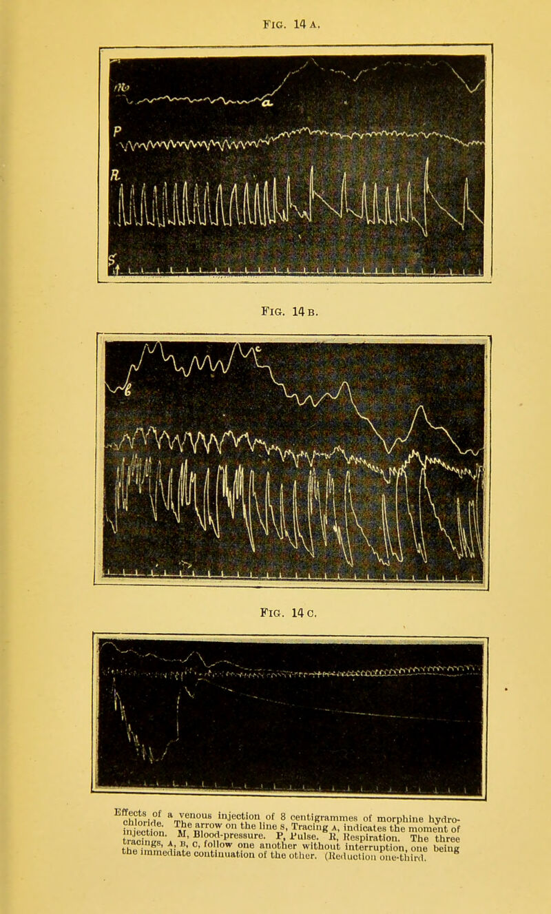 Fig. 14 a. cWoHrii thJ injection of 8 centigrammes of morphine hydro- fniection M ni T ° ^^^ .TT'* ^' x^icates the moment of radnls » «'?'?°nP'''''''''- A'»se K, IJespiration. The three thH nm'J;„f' .1 Other without interruption, one being the immediate continuation of the other. (Ueductiou one-tliin)