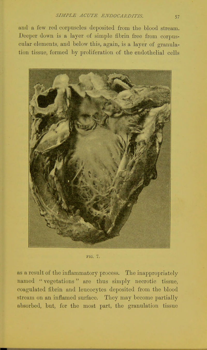 and a few red corpuscles deposited from the blood stream. Deeper down is a layer of simple fibrin free from corpus- cular elements, and below this, again, is a layer of granula- tion tissue, formed by proliferation of the endothelial cells FIG. 7. as a result of the inflammatory process. The inaj)j)ropriately named  vegetations are thus simply necrotic tissue, coagulated fibrin and leucocytes deposited from the blood stream on an inflamed surface. They may become partially absorbed, but, for the most part, the granulation tissue