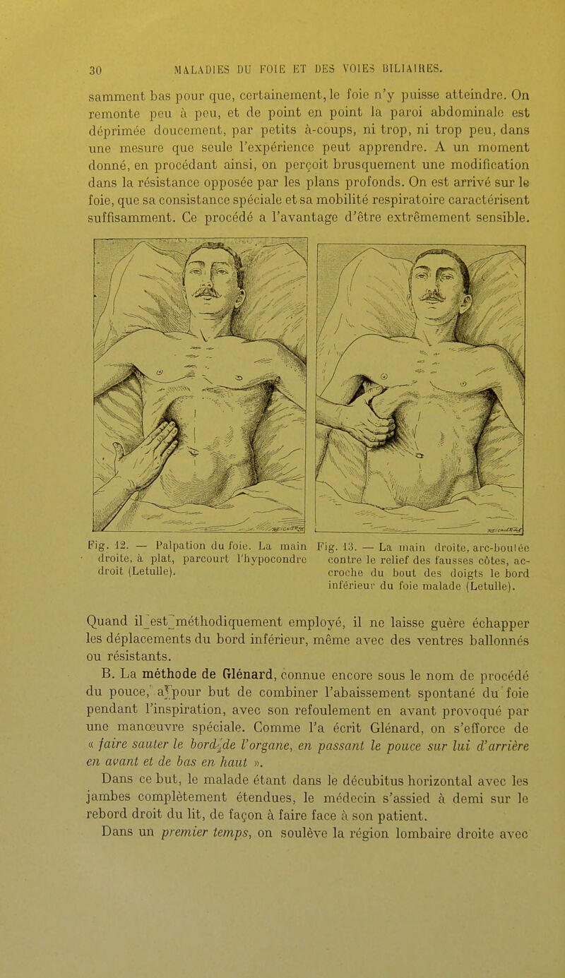 sammcnt bas pour que, certaine ment, le foie n'y puisse atteindre. On remonte peu à peu, et de point en point la paroi abdominale est déprimée doucement, par petits à-coups, ni trop, ni trop peu, dans une mesure que seule l'expérience peut apprendre. A un moment donné, en procédant ainsi, on perçoit brusquement une modification dans la résistance opposée par les plans profonds. On est arrivé sur le foie, que sa consistance spéciale et sa mobilité respiratoire caractérisent suffisamment. Ce procédé a l'avantage d'être extrêmement sensible. Fig. 12. — Palpation du foie. La main droite, à plat, parcourt l'hiypocondrc droit (Letulle). Fig. 13. — La main droite, arc-boulée contre le relief des fausses côtes, ac- croche du bout des doigts le bord inférieur du foie malade (Letulle). Quand irest^méthodiquement employé, il ne laisse guère échapper les déplacements du bord inférieur, même avec des ventres ballonnés ou résistants. B. La méthode de (rlénard, connue encore sous le nom de procédé du pouce,' a^^pour but de combiner l'abaissement spontané du'foie pendant l'inspiration, avec son refoulement en avant provoqué par une manœuvre spéciale. Comme l'a écrit Glénard, on s'efforce de « jaire sauter le bord-j^de l'organe, en passant le pouce sur lui d'arrière en avant et de bas en haut ». Dans ce but, le malade étant dans le décubitus horizontal avec les jambes complètement étendues, le médecin s'assied à demi sur le rebord droit du lit, de façon à faire face à son patient. Dans un premier temps, on soulève la région lombaire droite avec