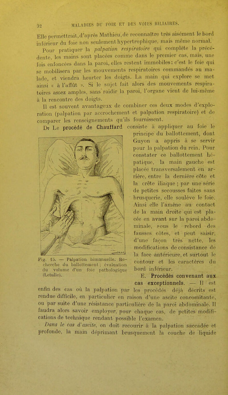 Elle permettrait, d'après Mathieu, de reconnaître très aisément le bord inférieur du foie non seulement hypertrophique, mais même normal. Pour pratiquer la palpation respiratoire qui complète la précé- dente, les mains sont placées comme dans le premier cas, mais, une fois enfoncées dans la paroi, elles restent immobiles : c'est le foie qui se mobilisera par les mouvements respiratoires commandés au ma- lade, et viendra heurter les doigts. La main qui explore se met ainsi « à l'affût ». Si le sujet fait alors des mouvements respira- toires assez amples, sans'raidir la paroi, l'organe vient de lui-même à la rencontre des doigts. Il est souvent avantageux de combiner ces deux modes d'explo- ration (palpation par accrochement et palpation respiratoire) et de comparer les renseignements qu'ils fournissent. D? Le procédé de Chauffard consiste à appliquer au foie le principe du ballottement, dont Guyon a appris à se servir pour la palpation du rein. Pour constater ce ballottement hé- patique, la main gauche est placée transversalement en ar- rière, entre la dernière côte et la crête iliaque ; par une série de petites secousses faites sans brusquerie, elle soulève le foie. Ainsi elle l'amène au contact de la main droite qui est pla- cée en avant sur la paroi abdo- minale, sous le rebord des fausses côtes, et peut saisir, d'une façon très nette, les modifications de consistance de la face antérieure, et surtout le contour et les caractères du bord inférieur. E. Procédés convenant aux cas exceptionnels. — Il est enfin des cas où la palpation par les procédés déjà décrits est rendue difficile, en particulier en raison d'une ascite concomitante, ou par suite d'une résistance particulière de la paroi abdominale. Il faudra alors savoir employer, pour chaque cas, de petites modifi- cations de technique rendant possible l'examen. Dans le cas d'ascite, on doit recourir à la palpation saccadée et profonde, la main déprimant brusquement la couche de liquide Fig. 1». — Palpation bimanuelle. Re- cherche du balloUement ; évaluation du volume d'un foie pathologique (LetuUe).