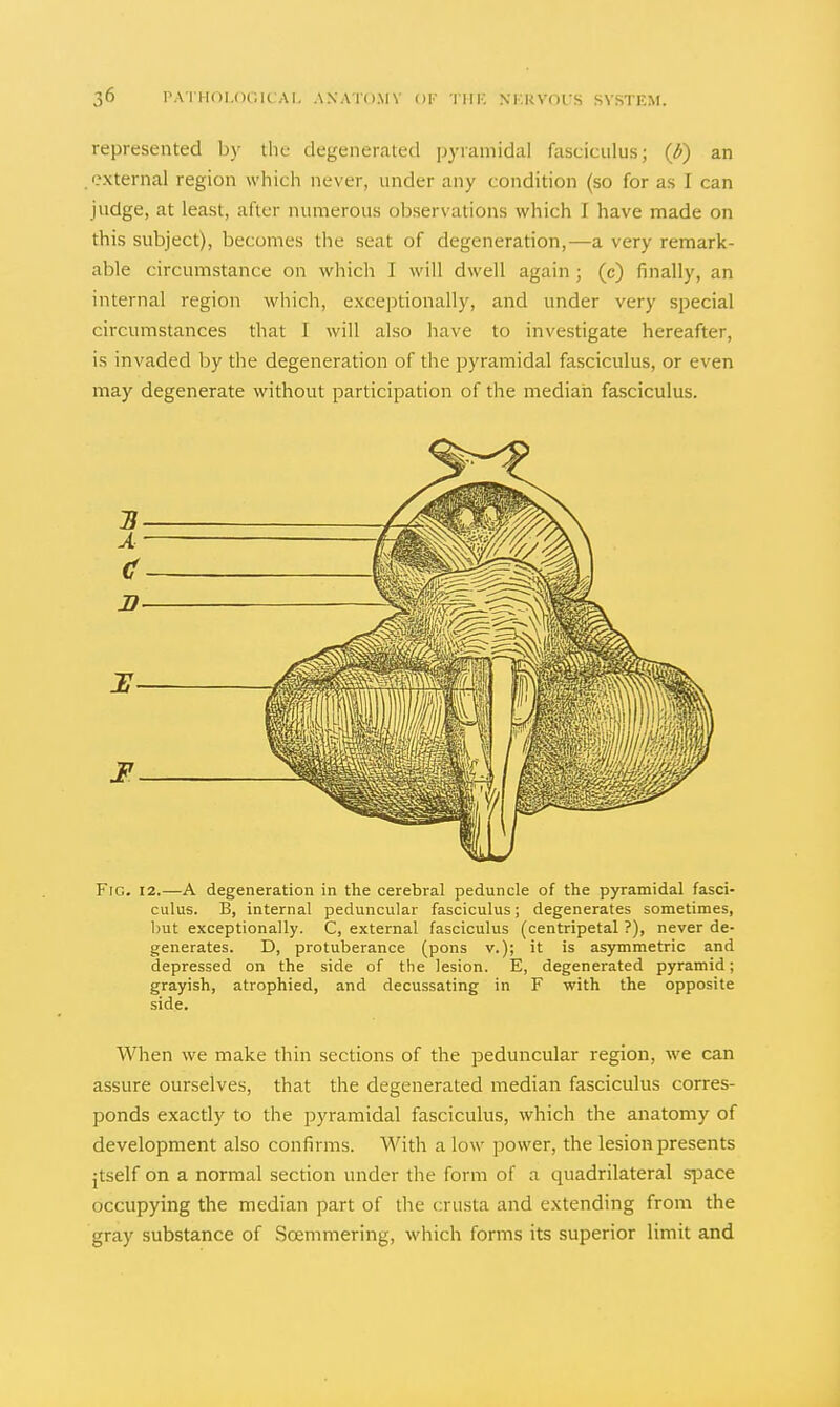 represented by tlie degenerated pyramidal fasciculus; (b) an .external region which never, under any condition (so for as I can judge, at least, after numerous observations which I have made on this subject), becomes the seat of degeneration,—a very remark- able circumstance on which I will dwell again; (c) finally, an internal region which, exceptionally, and under very special circumstances that I will also have to investigate hereafter, is invaded by the degeneration of the pyramidal fasciculus, or even may degenerate without participation of the median fasciculus. Fig. 12.—A degeneration in the cerebral peduncle of the pyramidal fasci- culus. B, internal peduncular fasciculus; degenerates sometimes, but exceptionally. C, external fasciculus (centripetal ?), never de- generates. D, protuberance (pons v.); it is asymmetric and depressed on the side of the lesion. E, degenerated pyramid; grayish, atrophied, and decussating in F with the opposite side. When we make thin sections of the peduncular region, we can assure ourselves, that the degenerated median fasciculus corres- ponds exactly to the pyramidal fasciculus, which the anatomy of development also confirms. With a low power, the lesion presents jtself on a normal section under the form of a quadrilateral space occupying the median part of the crusta and extending from the gray substance of Soemmering, which forms its superior limit and