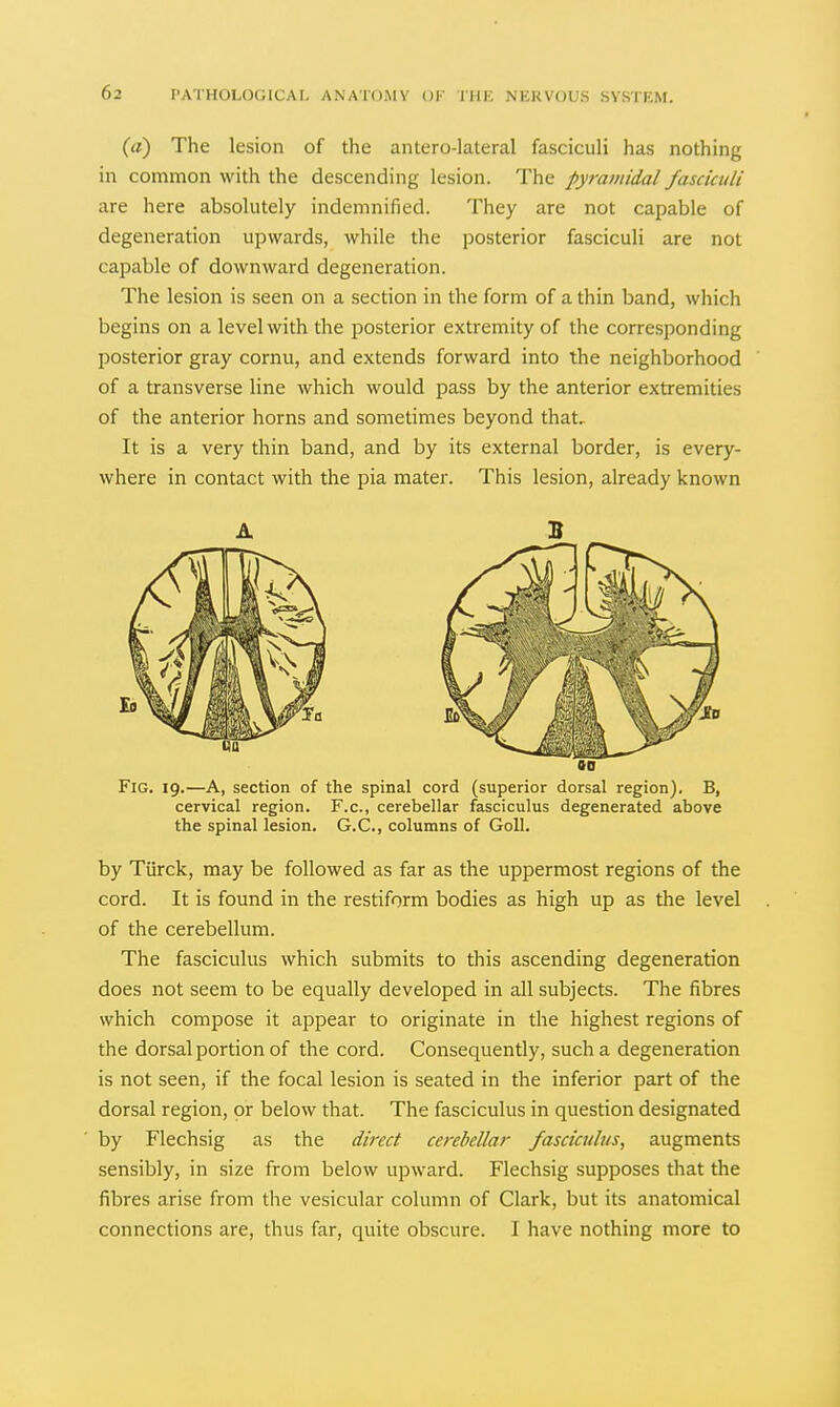 («) The lesion of the antero-lateral fasciculi has nothing in common with the descending lesion. The pyramidal fasciculi are here absolutely indemnified. They are not capable of degeneration upwards, while the posterior fasciculi are not capable of downward degeneration. The lesion is seen on a section in the form of a thin band, which begins on a level with the posterior extremity of the corresponding posterior gray cornu, and extends forward into the neighborhood of a transverse line which would pass by the anterior extremities of the anterior horns and sometimes beyond that. It is a very thin band, and by its external border, is every- where in contact with the pia mater. This lesion, already known A 5 Fig. 19.—A, section of the spinal cord (superior dorsal region). B, cervical region. F.c, cerebellar fasciculus degenerated above the spinal lesion. G.C., columns of Goll. by Turck, may be followed as far as the uppermost regions of the cord. It is found in the restiform bodies as high up as the level of the cerebellum. The fasciculus which submits to this ascending degeneration does not seem to be equally developed in all subjects. The fibres which compose it appear to originate in the highest regions of the dorsal portion of the cord. Consequently, such a degeneration is not seen, if the focal lesion is seated in the inferior part of the dorsal region, or below that. The fasciculus in question designated by Flechsig as the direct cerebellar fasciculus, augments sensibly, in size from below upward. Flechsig supposes that the fibres arise from the vesicular column of Clark, but its anatomical connections are, thus far, quite obscure. I have nothing more to