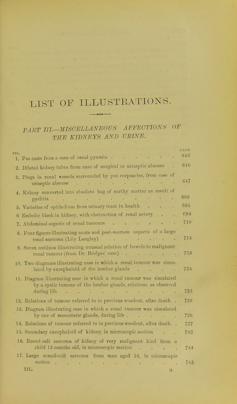 LIST OF ILLUSTRATIONS. —•<>*— PART in.-MISGELLANEOUS AFFECTIONS OF THE KIDNEYS AND URINE. FIG rAUR 647 660 1. Pus casts from a case of renal pysemia 2. Dilated kidney tubes from case of surgical or uriseptic abscess . 6IG 3. Plugs in renal vessels surrounded by pus corpiiseles, from case of uriseptic abscess 4. Kidney converted into obsolete bag of earthy 7ii;itter as result of pyelitis 5. Varieties of epithelium from urinary tract in health . . . 66o 6 Embolic block in kidney, with obstruction of renal artery . . 694 7. Abdominal aspects of renal tumours 710 8. Four figures illustrating acute and post-mortem aspects of a large renal sarcoma (Lily Langley) 714 9. Seven outlines illustrating unusual relation of bowels to malignant renal tumour (from Dr. Bridge.s' case) 718 10. Two diagrams illustrating c;ise in which a renal tumour was simu- lated l)y encephaloid of the lumbur glands .... 724 11. Diagram illustrating case in which a renal tun)our was simulated by a cystic tumour of the lumbar glands, i-elations as observed during life .......... 72') 12. Kelations of tumour referred to in previous woodcut, after death . 726 13. Diagram illustrating case in which a renal tumour was simulated by one of mesenteric glands, during life ..... 726 14. Relations of tumour referred to in previous woodcut, after death . 727 10. Secondary encephaloid of kidney, in microscopic section . . 742 16. Round-cell sarcoma of kidney of very malignant kind from a child 13 months old, in microscopic section .... 744 17. Large round-cell sarcoma from man aged IM, in microscopic section 7-15 III. a,