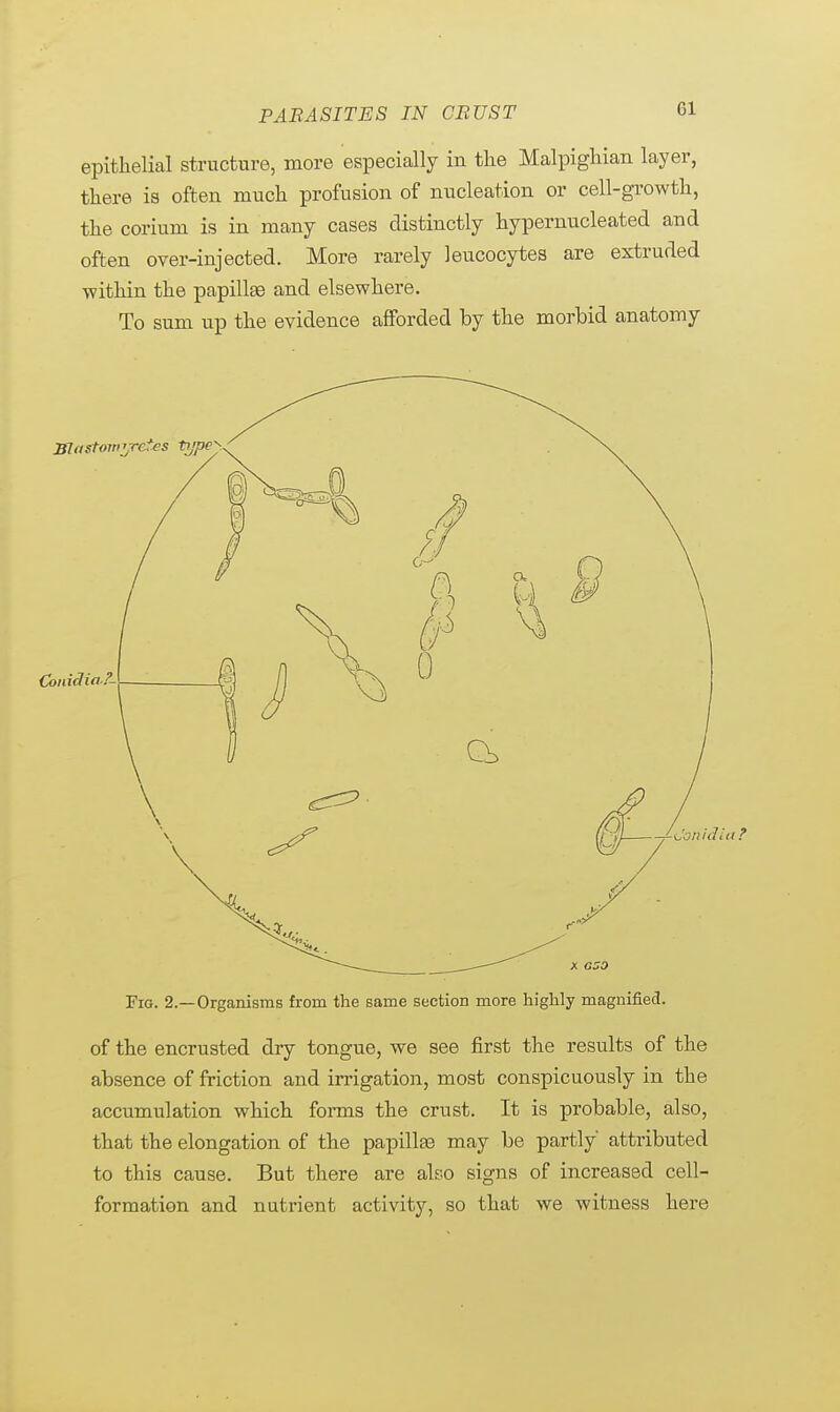 P ABA SITES IN CBUST epithelial structure, more especially in the Malpighian layer, there is often much profusion of nucleation or cell-growth, the corium is in many cases distinctly hypernucleated and often over-injected. More rarely leucocytes are extruded ■within the papillae and elsewhere. To sum up the evidence afforded by the morbid anatomy Fig. 2.—Organisms from the same section more highly magnified. of the encrusted dry tongue, we see first the results of the absence of friction and irrigation, most conspicuously in the accumulation which forms the crust. It is probable, also, that the elongation of the papillae may be partly attributed to this cause. But there are also signs of increased cell- formation and nutrient activity, so that we witness here