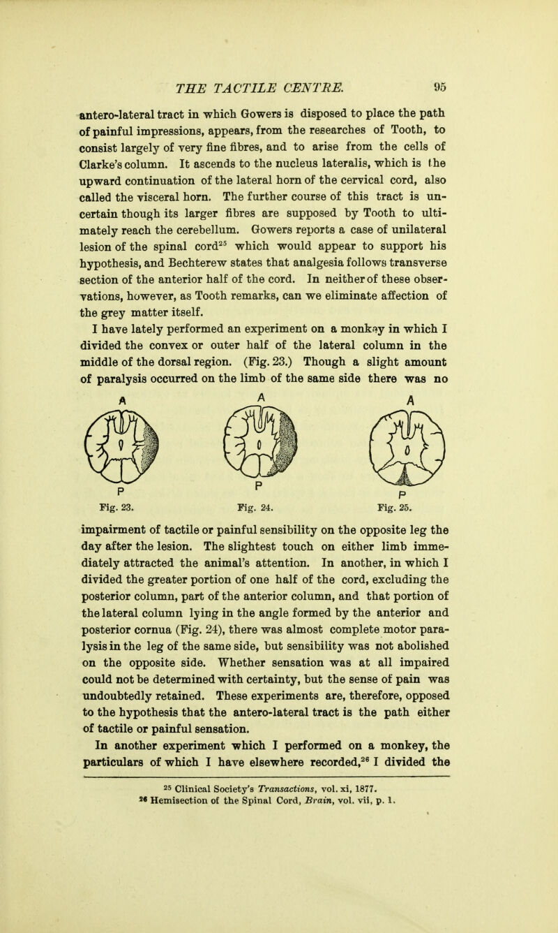 antero-Iateral tract in which Gowers is disposed to place the path of painful impressions, appears, from the researches of Tooth, to consist largely of very fine fibres, and to arise from the cells of Clarke's column. It ascends to the nucleus lateralis, which is ( he upward continuation of the lateral horn of the cervical cord, also called the visceral horn. The further course of this tract is un- certain though its larger fibres are supposed by Tooth to ulti- mately reach the cerebellum. Gowers reports a case of unilateral lesion of the spinal cord^^ which would appear to support his hypothesis, and Bechterew states that analgesia follows transverse section of the anterior half of the cord. In neither of these obser- vations, however, as Tooth remarks, can we eliminate affection of the grey matter itself. I have lately performed an experiment on a monkoy in which I divided the convex or outer half of the lateral column in the middle of the dorsal region. (Fig. 23.) Though a slight amount of paralysis occurred on the limb of the same side there was no A A A Fig. 23. Fig. 24. Fig. 25. impairment of tactile or painful sensibility on the opposite leg the day after the lesion. The slightest touch on either limb imme- diately attracted the animal's attention. In another, in which I divided the greater portion of one half of the cord, excluding the posterior column, part of the anterior column, and that portion of the lateral column lying in the angle formed by the anterior and posterior cornua (Fig. 24), there was almost complete motor para- lysis in the leg of the same side, but sensibility was not abolished on the opposite side. Whether sensation was at all impaired could not be determined with certainty, but the sense of pain was undoubtedly retained. These experiments are, therefore, opposed to the hypothesis that the antero-lateral tract is the path either of tactile or painful sensation. In another experiment which I performed on a monkey, the particulars of which I have elsewhere recorded,^^ I divided the 25 Clinical Society's Transactions, vol. xi, 1877. Hemisection of the Spinal Cord, Brain, vol. vii, p. 1.