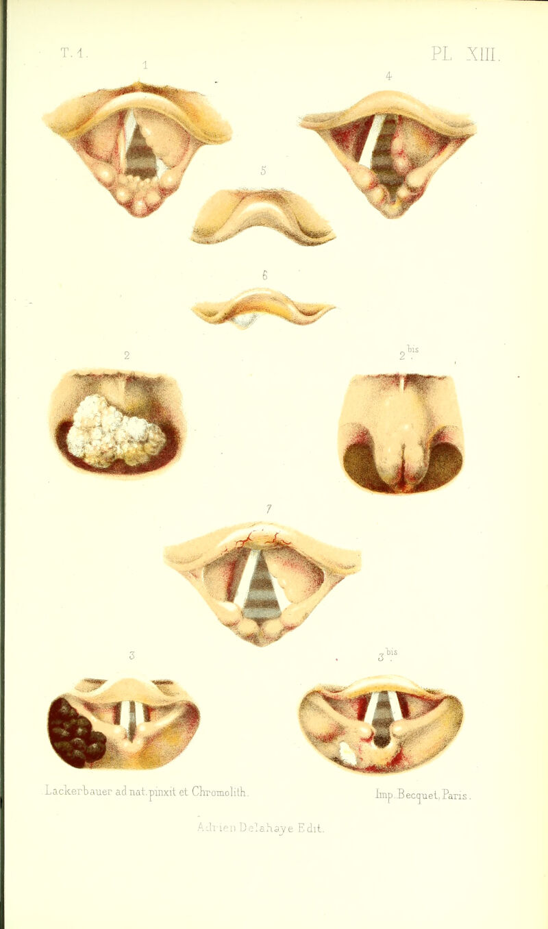 T. 1. 1 PL XIII 4 AdT'ien Delahaj/e Edit.