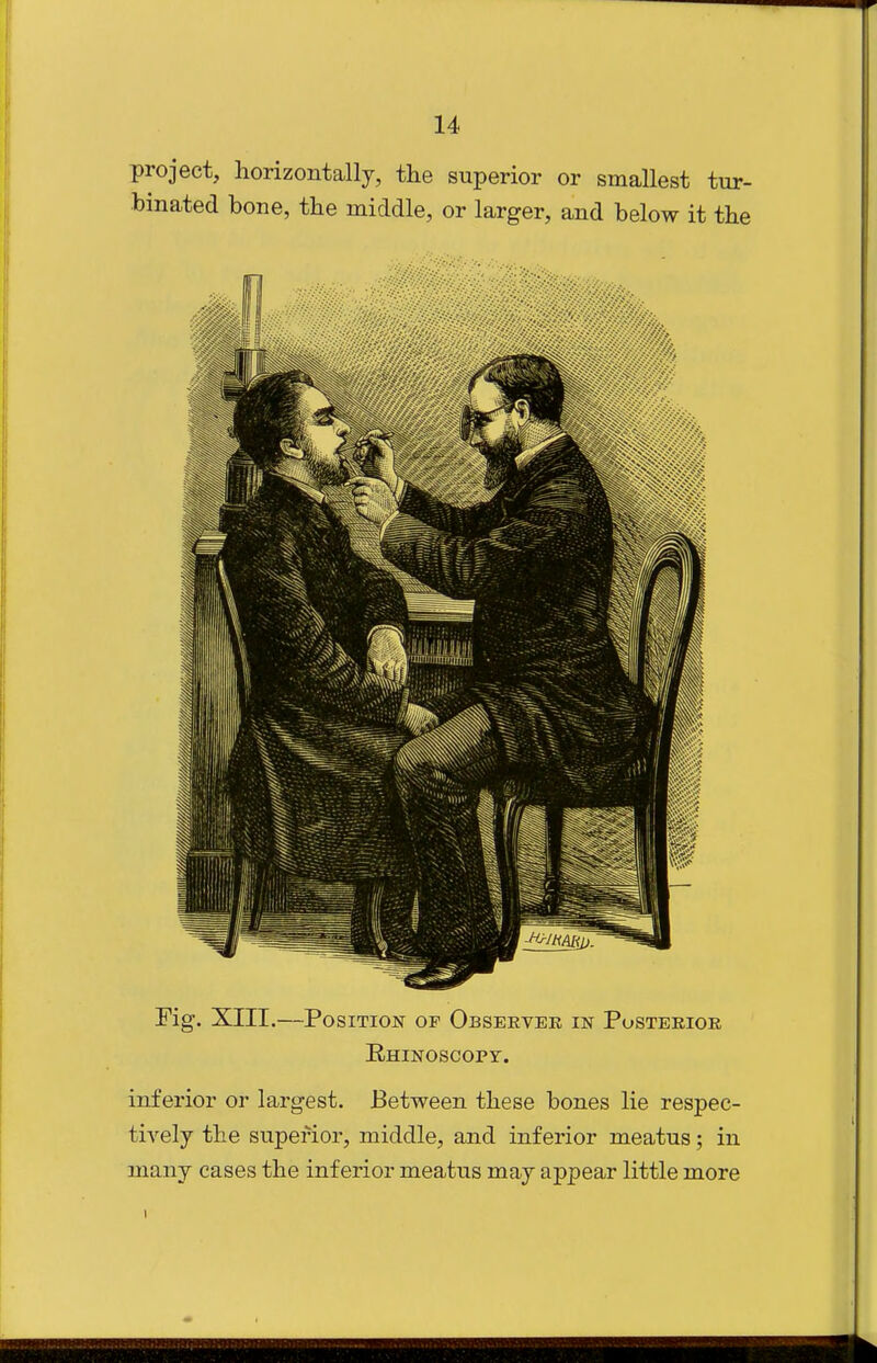 project, horizontally, the superior or smallest tur- binated bone, the middle, or larger, and below it the Fig. XIII.—Position op Observer in Posterior E.HINOSCOPY. inferior or largest. Between these bones lie respec- tively the supei'ior, middle, and inferior meatus; in many cases the inferior meatus may appear little more
