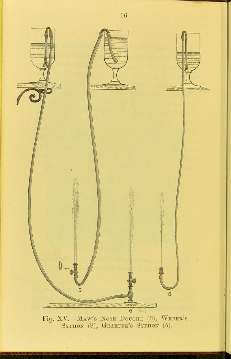 IG 6 W\ Fig. XV.—Maw's Nose DoucHi!; (6), Weber's Syphon (8), Geabffe's Syphon (5).