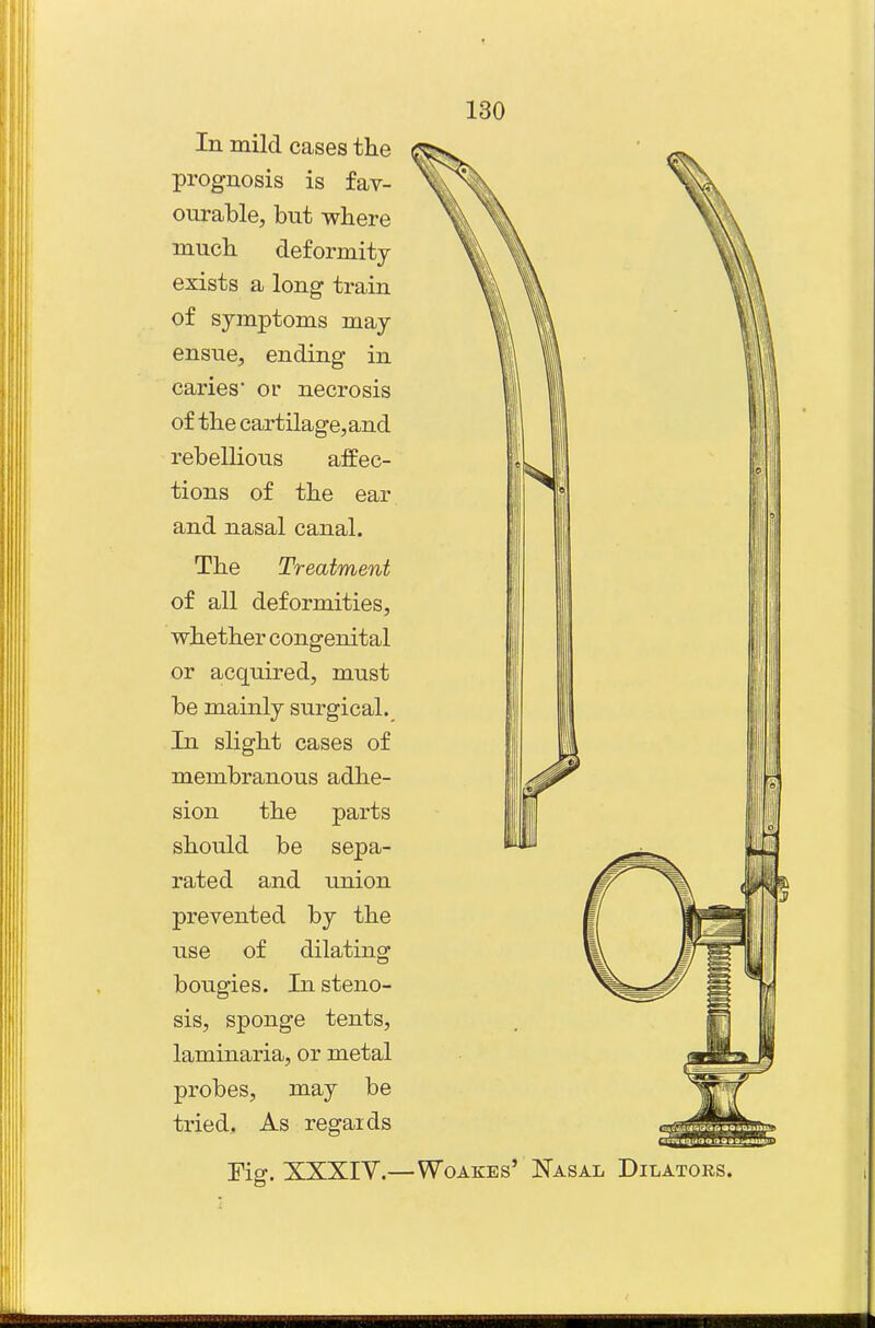 In mild cases the prognosis is fav- ourable, but where mucli deformity exists a long train of symptoms may ensue, ending in caries or necrosis of the cartilage, and rebellious affec- tions of the ear and nasal canal. The Treatment of all deformities, whether congenital or acquired, must be mainly surgical. In slight cases of membranous adhe- sion the parts should be sepa- rated and union prevented by the use of dilating bougies. In steno- sis, sponge tents, laminaria, or metal probes, may be tried. As regards rig. XXXIY.—WoAKEs' Nasal Dilators.