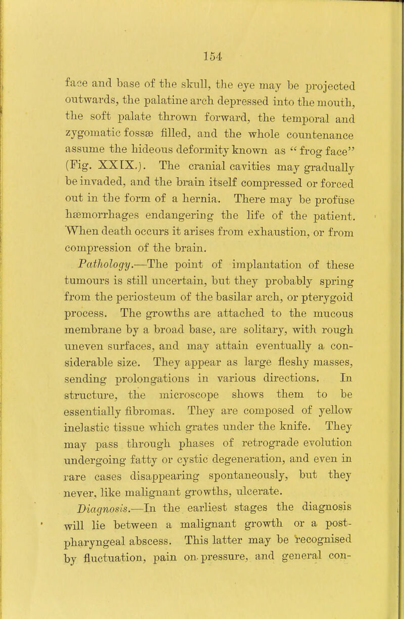 face and base of the skull, the eye may be projected outwards, tlie palatine arch depressed into the mouth, the soft palate thrown forward, the temporal and zygomatic fossae filled, and the whole countenance assume the hideous deformity known as  frog face (Fig. XXIX.). The cranial cavities may gradually be invaded, and the brain itself compressed or forced out in the form of a hernia. There may be profuse hsemorrhages endangering the life of the patient. When death occurs it arises from exhaustion, or from compression of the brain. Pathology.—The point of implantation of these tumours is still uncertain, but they probably spring from the periosteum of the basilar arch, or pterygoid process. The growths are attached to the mucous membrane by a broad base, are sohtary, with rough uneven surfaces, and may attain eventually a con- siderable size. They appear as large fleshy masses, sending prolongations in various directions. In structure, the microscope shows them to be essentially fibromas. They are composed of yellow inelastic tissue which grates under the knife. They may pass through phases of retrograde evolution undergoing fatty or cystic degeneration, and even in rare cases disappearing spontaneously, but they never, like malignant growths, ulcerate. Diagnosis.—In the earliest stages the diagnosis will lie between a malignant growth or a post- pharyngeal abscess. This latter may be recognised by fluctuation, pain on pressure, and general con-