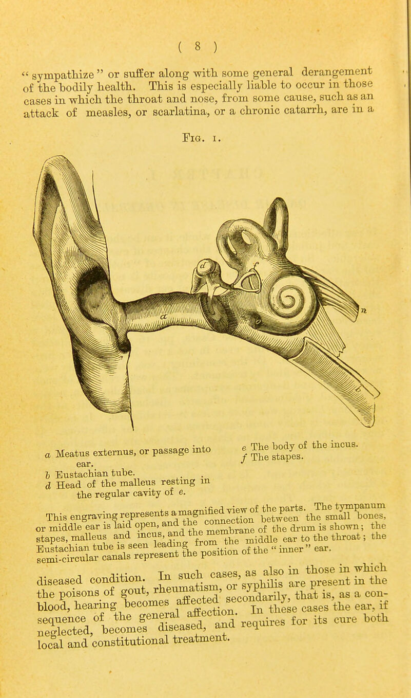  sympathize  or suffer along with some general derangement of the bodily health. This is especially liable to occur in those cases in which the throat and nose, from some cause, such as an attack of measles, or scarlatina, or a chronic catarrh, are in a Fig. i. . Meat*, edemas, or passage into * The body of the iacas. ear. J b Eustachian tube. d Head of the malleus resting m the regular cavity of e. or middle ear is laid open, and,^ ™^r'ne 0f the drum is shown; the stapes, malleus and ™^d* fr<S^KiMle ear to the throat; the KSS^rSfc of the - inner ear. leased condition In * ^ S£ the poisons of gout, rheumatism, ^ . as a cou. blood, hearing becomes aW*eo naar y ^ .f sequence of the general affection. In te ^ neglected, becomes diseased, and lequnes local and constitutional treatment.