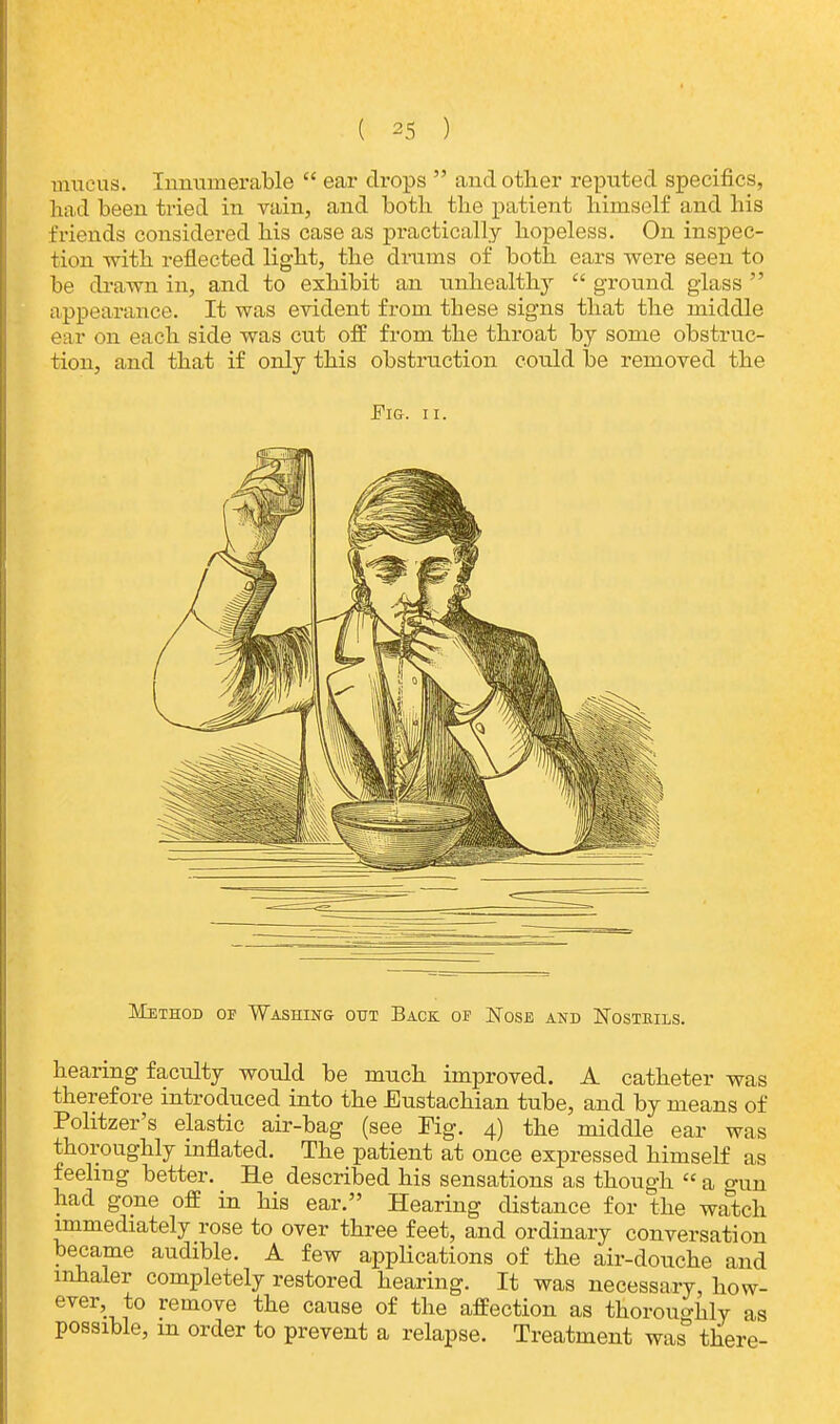 mucus. Innumerable  ear drops  and other reputed specifics, had been tried in vain, and both the patient himself and his friends considered his case as practically hopeless. On inspec- tion with reflected light, the drains of both ears were seen to be drawn in, and to exhibit an unhealthy  ground glass  appearance. It was evident from these signs that the middle ear on each side was cut off from the throat by some obstruc- tion, and that if only this obstruction could be removed the Fig. ii. Method op Washing out Back of Nose and Nostrils. hearing faculty would be much improved. A catheter was therefore introduced into the Eustachian tube, and by means of Politzer's elastic air-bag (see Tig. 4) the middle ear was thoroughly inflated. The patient at once expressed himself as feeling better. He described his sensations as though  a o-Un had gone off in his ear. Hearing distance for the watch immediately rose to over three feet, and ordinary conversation became audible. A few applications of the air-douche and inhaler completely restored hearing. It was necessary, how- ever to remove the cause of the affection as thoroughly as possible, in order to prevent a relapse. Treatment was& there-