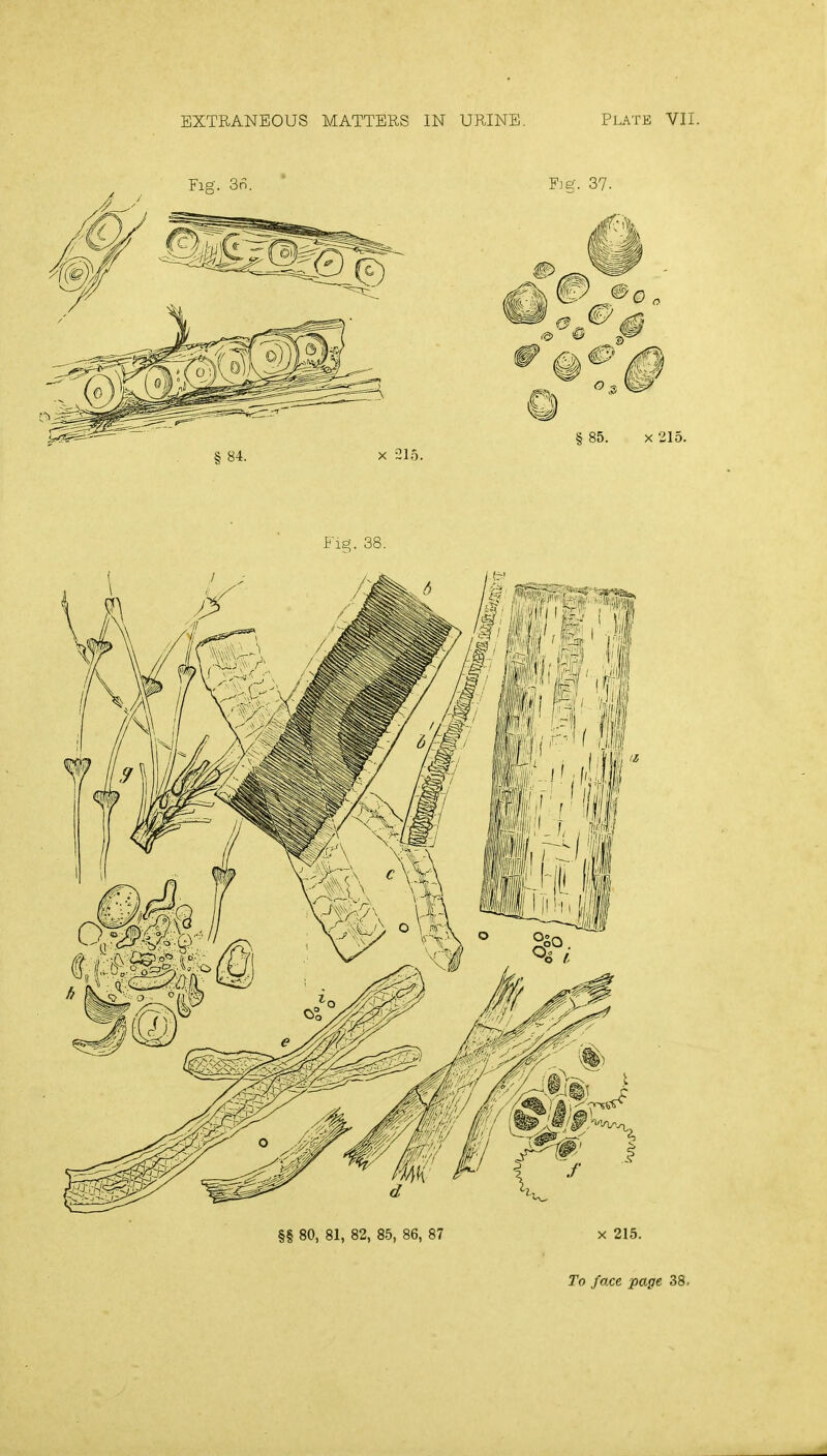 EXTRANEOUS MATTERS IN URINE. Platk VII. §§ 80, 81, 82, 85, 86, 87 x 215. To face page 38.