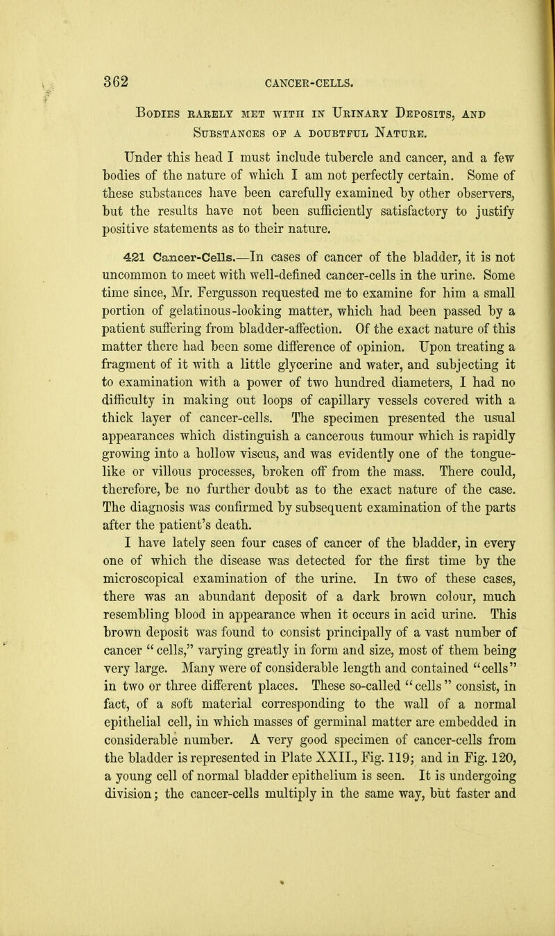 Bodies barely met with in Urinary Deposits, and Substances of a doubtful Nature. Under this head I must include tubercle and cancer, and a few bodies of the nature of which I am not perfectly certain. Some of these substances have been carefully examined by other observers, but the results have not been sufficiently satisfactory to justify positive statements as to their nature. 421 Cancer-Cells.—In cases of cancer of the bladder, it is not uncommon to meet with well-defined cancer-cells in the urine. Some time since, Mr, Fergusson requested me to examine for him a small portion of gelatinous-looking matter, which had been passed by a patient suffering from bladder-affection. Of the exact nature of this matter there had been some difference of opinion. Upon treating a fragment of it with a little glycerine and water, and subjecting it to examination with a power of two hundred diameters, I had no difficulty in making out loops of capillary vessels covered with a thick layer of cancer-cells. The specimen presented the usual appearances which distinguish a cancerous tumour which is rapidly growing into a hollow viscus, and was evidently one of the tongue- like or villous processes, broken off from the mass. There could, therefore, be no further doubt as to the exact nature of the case. The diagnosis was confirmed by subsequent examination of the parts after the patient's death. I have lately seen four cases of cancer of the bladder, in every one of which the disease was detected for the first time by the microscopical examination of the urine. In two of these cases, there was an abundant deposit of a dark brown colour, much resembling blood in appearance when it occurs in acid urine. This brown deposit was found to consist principally of a vast number of cancer  cells, varying greatly in form and size, most of them being very large. Many were of considerable length and contained cells in two or three different places. These so-called  cells  consist, in fact, of a soft material corresponding to the wall of a normal epithelial cell, in which masses of germinal matter are embedded in considerable number. A very good specimen of cancer-cells from the bladder is represented in Plate XXII., Fig. 119; and in Fig. 120, a young cell of normal bladder epithelium is seen. It is undergoing division; the cancer-cells multiply in the same way, biit faster and