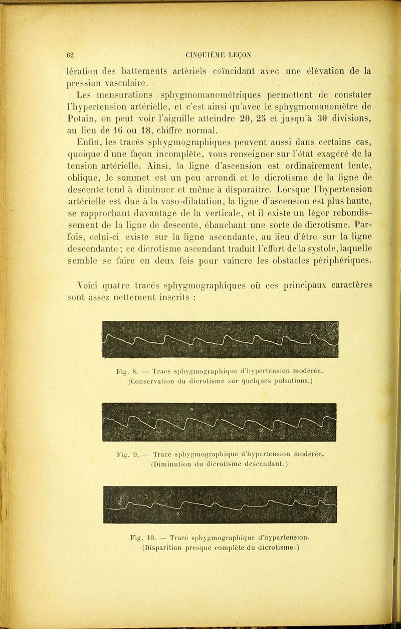 lération des battements artériels coïncidant avec une élévation de la pression vasculaire. Les mensurations sphygmomanométriques permettent de constater l'hypertension artérielle, et c'est ainsi qu'avec le sphygmomanomètre de Potain, on peut voir l'aiguille atteindre 20, 25 et jusqu'à 30 divisions, au lieu de 16 ou 18, chiffre normal. Enfin, les tracés sphygmographiques peuvent aussi dans certains cas, quoique d'une façon incomplète, vous renseigner sur l'état exagéré de la tension artérielle. Ainsi, la ligne d'ascension est ordinairement lente, oblique, le sommet est un peu arrondi et le dicrotisme de la ligne de descente tend à diminuer et même à disparaître. Lorsque l'hypertension artérielle est due à la vaso-dilatation, la ligne d'ascension est plus haute, se rapprochant davantage de la verticale, et il existe un léger rebondis- sement de la ligne de descente, ébauchant une sorte de dicrotisme. Par- fois, celui-ci existe sur la ligne ascendante, au lieu d'être sur la ligne descendante ; ce dicrotisme ascendant traduit l'effort de la systole, laquelle semble se faire en deux fois pour vaincre les obstacles périphériques. Voici quatre tracés sphygmographiques où ces principaux caractères sont assez nettement inscrits : Fig. 8. — Traré sphygmographique d'hypertension modérée. (Conservalion du dicrotisme sur quelques pulsations.) Fig. 9. — Tracé sphygmographique d'hypertension modérée. (Diminution du dicrotisme descendant.) Fig. 10. — Tracé sphygmographique d'hypertension. (Disparition presque complète du dicrotisme.)