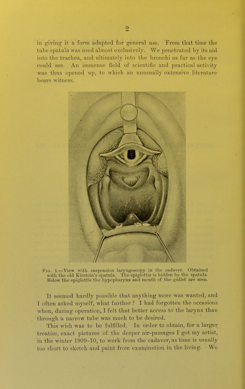 in giving it a form adapted for general use. From that time the tube spatula was used almost exclusively. We penetrated by its aid into the trachea, and ultimately into the bronchi as far as the eye could see. An immense field of scientific and pi'actical activity was thus opened up, to which an unusually extensive literature bears witness. Fig. 1.—View with suspension laryngoscopy in the cadaver. Obtained with the old Kirstein's spatula. The epiglottis is hidden by the spatula. Below the epiglottis the hypopharynx and mouth of the gullet are seen. It seemed hardly possible that anything moi'e was wanted, and I often asked myself, what further ? I had forgotten the occasions when^ during operation, I felt that better access to the larynx than through a narrow tube was much to be desired. This wish was to be fulfilled. In order to obtain, for a larger treatise, exact pictures of the deeper air-passages I got my artist, in the winter 1909-10, to work from the cadaver, as time is usually too short to sketch and paiiit from examination in the living. We