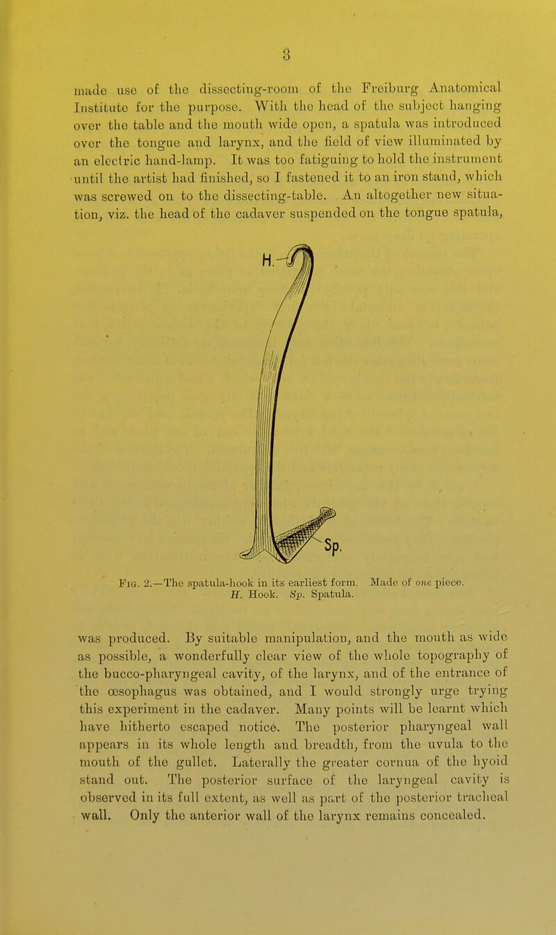 made use of tlie dissecting-room of the Freiburg Anatomical Institute for the purpose. Witli the head of the subject hanging over the table and the mouth wide open, a spatula was introduced over the tongue and larynx, and the field of view illuminated by an electric hand-lamp. It was too fatiguing to hold the instrument •until the artist had finished, so I fastened it to an iron stand, which was screwed on to the dissecting-table. An altogether new situa- tion, viz. the head of the cadaver suspended on the tongue spatula. Fig. 2.—The spatula-liook in its earliest form. Made of one piece. H. Hook. Sp. Spatula. was produced. By suitable manipulation, and the mouth as wide as possible, a wonderfully clear view of the whole topography of the bucco-pharyngeal cavity, of the lai-ynx, and of the entrance of the oesophagus was obtained, and I would strongly urge trying this experiment in the cadaver. Many points will be learnt which have hitherto escaped notice. The posterior pharyngeal wall appears in its whole length and breadth, from the uvula to the mouth of the gullet. Laterally the greater cornua of the hyoid stand out. The posterior surface of the laryngeal cavity is observed in its full extent, as well flS Pet rt of the posterior tracheal wall. Only the anterior wall of the larynx remains concealed.
