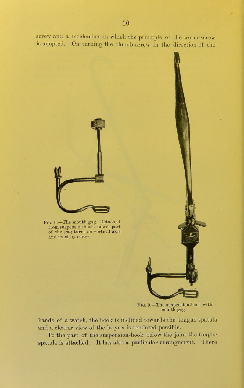 screw and a moclianism in which the principle of the worm-screw is adopted. On turning the thumb-screw in the direction of tlie I Fig. 9.—The suspension-hook with mouth gag. hands of a watch^ the hook is inclined towards the tongue spatula and a clearer view of the larynx is rendered possible. To the part of the suspension-hook below the joint the tongue spatula is attached. It has also a particular arrangement. There