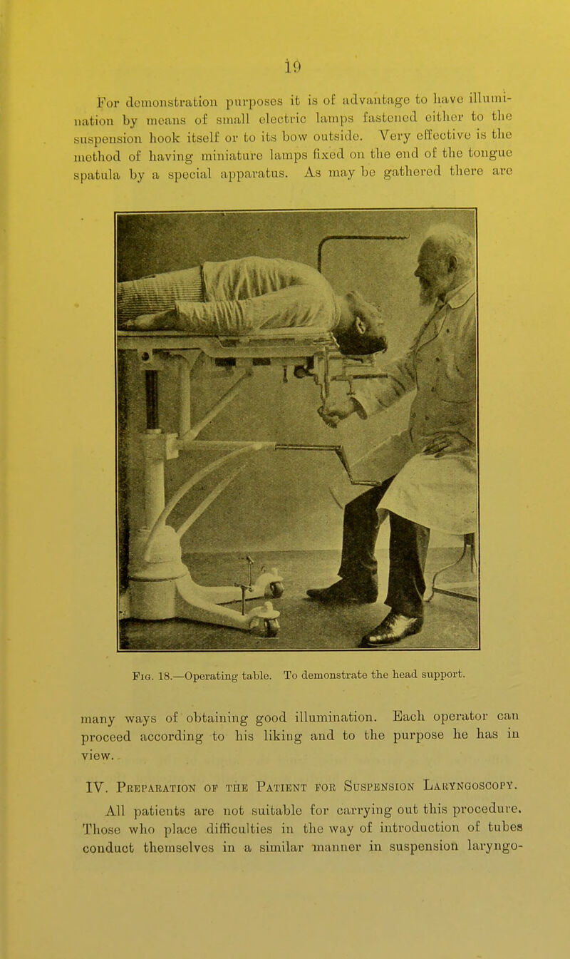 id For demonstration purposes it is of advantage to have illumi- nation by means of small electric lamps fastened oitlier to the suspension hook itself or to its bow outside. Very effective is the method of having miniature lamps fixed on the end ol; the tongue spatula by a special apparatus. As may be gathered there are Fig. 18.—Operating table. To demonstrate the head support. many ways of obtaining good illumination. Each operator can proceed according to his liking and to the purpose he has in view. IV. Preparation of the Patient for Suspension Laryngoscopy. All patients are not suitable for carrying out this procedure. Those who place difficulties in the way of introduction of tubes conduct themselves in a similar manner in suspension laryngo-