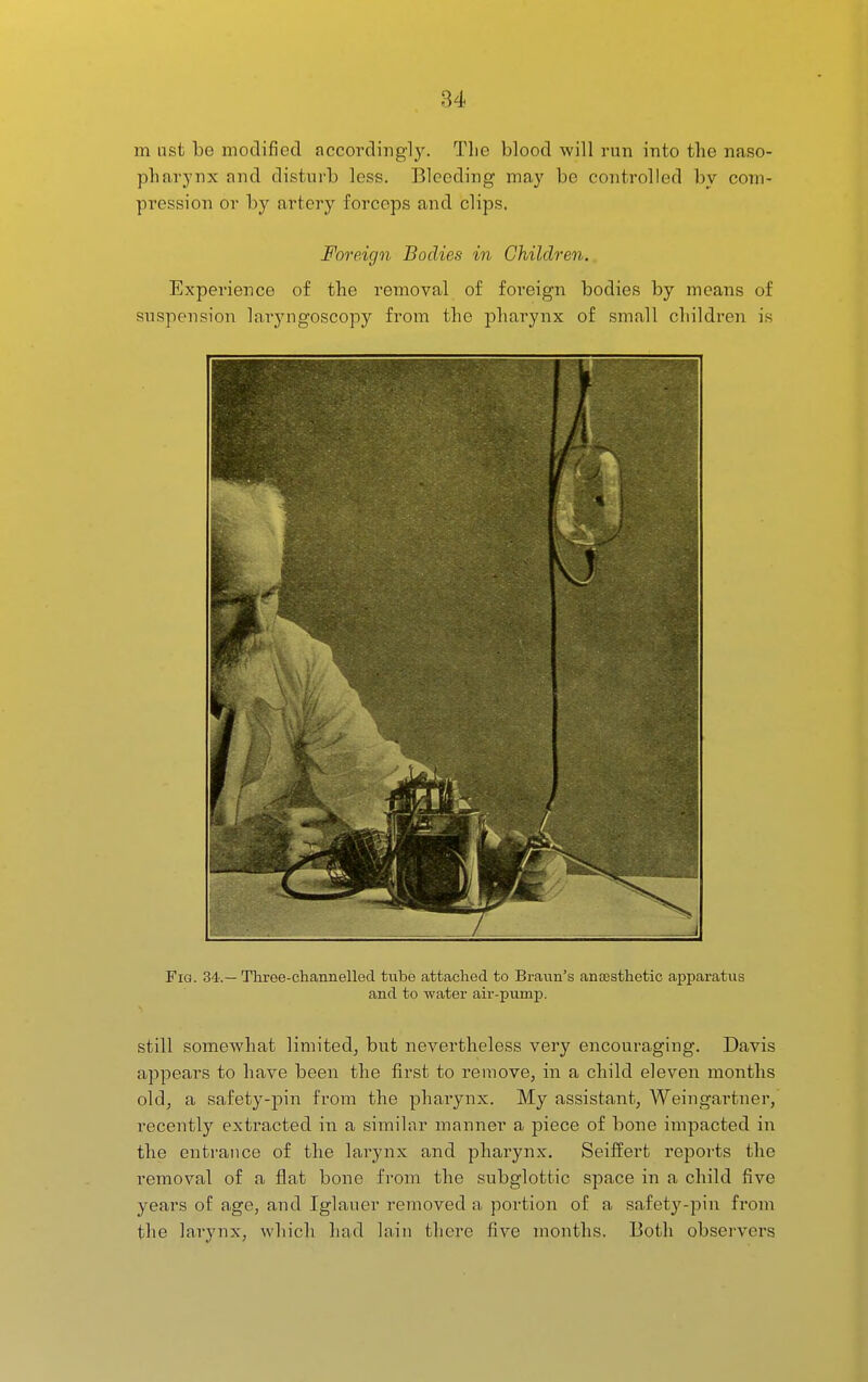 m ust be modified accordingly. The blood will run into the naso- pharynx and disturb less. Bleeding may be controlled by com- pression or by artery forceps and clips. Foreign Bodies in Children. Experience of the removal of foreign bodies by means of suspension larjmgoscopy from the pharynx of small children is Fig. 34.— Three-channelled tube attached to Braun's ansesthetic apparatus and to water air-pumjp. still somewhat limited, but nevertheless very encouraging. Davis appears to have been the first to remove, in a child eleven months old, a safety-pin from the pharynx. My assistant, Weingartner, i-ecently extracted in a similar manner a piece of bone impacted in the entrance of the larynx and pharynx. Seiiiert reports the removal of a flat bone from the subglottic space in a child five years of age, and Iglauer removed a portion of a safety-pin from the larynx, which had lain there five months. Both observers