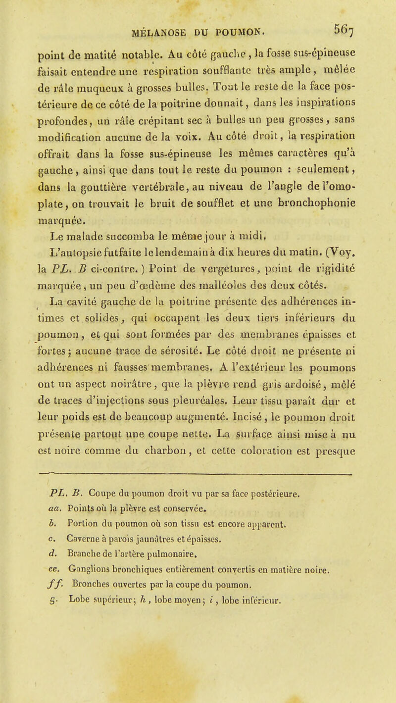 point <3g matité notable. Au côté gauclic, la fosse sus-cpineuse faisait entendre une respiration soufflante très ample, mêlée de râle muqucux à grosses bulles. Tout le reste de la face pos- térieure de ce côté de la poitrine donnait, dans les inspirations profondes, un râle crépitant sec à bulles un peu grosses, sans modification aucune de la voix. Au côté droit, ia respiration offrait dans la fosse sus-épineuse les mêmes caractères qu'à gauche, ainsi que dans tout le reste du poumon : seulement, dans la gouttière vertébrale, au niveau de l'angle de l'omo- plate, on trouvait le bruit de soufflet et une broncliophonie marquée. Le malade succomba le même jour à midi. L'autopsie futfaite le lendemain à dix heures du matin. (Voy. la PL. B ci-contre.) Point de vergetures^ point de rigidité marquée, un peu d'œdème des malléoles des deux côtés. La cavité gauche de la poitrine présente des adhérences in- times et solides, qui occupent les deux tiers inférieurs du poumon, et qui sont formées par des membranes épaisses et fortes 5 aucune trace de sérosité. Le côté droit ne présente ni adhérences ni fausses membranes. A l'extérieur les poumons ont un aspect noirâtre, que la plèvre rend gris ardoisé, mêlé de traces d'injections sous pleuréales. Leur tissu paraît dur et leur poids est de beaucoup augmenté. Incisé, le poumon droit présente partout une coupe nette. La surface ainsi mise à nu est noire comme du charbon, et cette coloration est presque PL, B. Coupe du poumon droit vu par sa face postérieure. aa. Points où la plèvre est conservée. h. Portion du poumon où son tissu est encore apparent. c. Caverne à parois jaunâtres et épaisses. d. Branche de l'artère pulmonaire. ee. Ganglions bronchiques entièrement convertis en matière noire. ff. Bronches ouvertes par la coupe du poumon, g. Lobe supérieur5 h, lobe moyen; i, lobe inférieur.