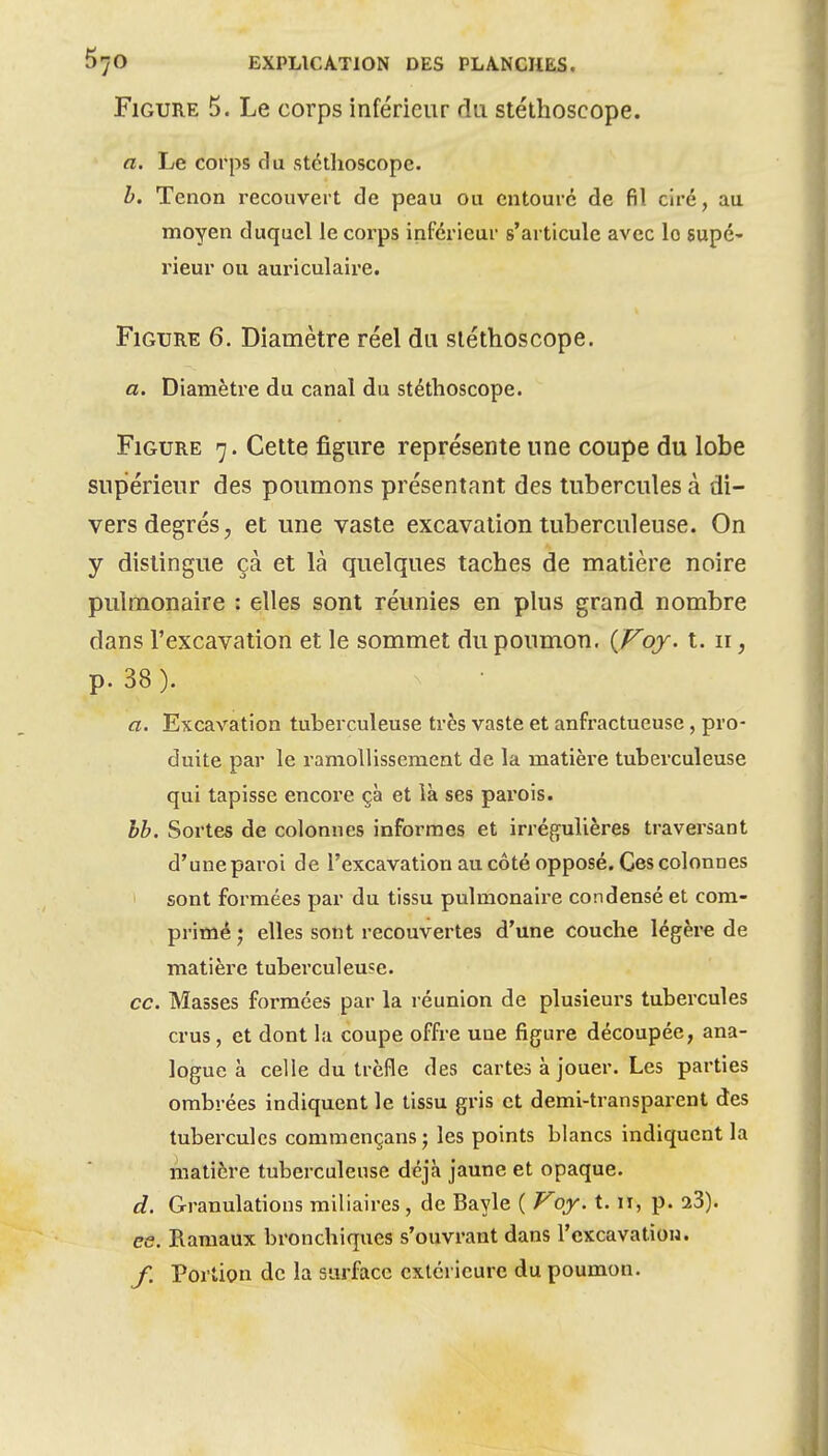 Figure 5. Le corps inférieur du stéthoscope. a. Le corps du stéthoscope. h. Tenon recouvert de peau ou entouré de fil ciré, au moyen duquel le corps inférieur s'articule avec lo supé- l'ieur ou auriculaire. Figure 6. Diamètre réel du stéthoscope. a. Diamètre du canal du stéthoscope. Figure 7. Cette figure représente une coupe du lobe supérieur des poumons présentant des tubercules à di- vers degrés, et une vaste excavation tuberculeuse. On y distingue çà et là quelques taches de matière noire pulmonaire : elles sont réunies en plus grand nombre dans l'excavation et le sommet du poumon. {Voy. t. 11, p. 38). a. Excavation tuberculeuse très vaste et anfractueuse, pro- duite par le ramollissement de la matière tuberculeuse qui tapisse encore çà et ià ses parois. hh. Sortes de colonnes informes et irrégulières traversant d'une paroi de l'excavation au côté opposé. Ces colonnes sont formées par du tissu pulmonaire condensé et com- primé ; elles sont recouvertes d'une couche légère de matière tuberculeuse. ce. Masses formées par la réunion de plusieurs tubercules crus, et dont la coupe offre une figure découpée, ana- logue à celle du trèfle des cartes à jouer. Les parties ombrées indiquent le tissu gris et demi-transparent des tubercules commençans; les points blancs indiquent la matière tuberculeuse déjà jaune et opaque. d. Granulations miliaires, de Bayle ( Voy. 1.11, p. 23). es. Ramaux bronchiques s'ouvrant dans l'excavation. f. Portion de la surface extérieure du poumon.