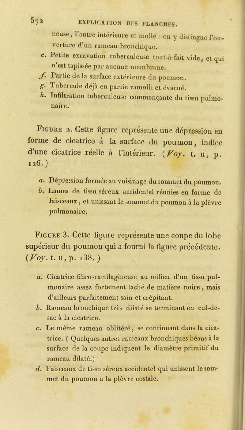 ncuse, l'autre intérieure et molle : on y distingue l'ou- verture d'un rameau bronchique, c. Petite excavation tuberculeuse tout-à-fait vide, et qui n'est tapissée par aucune membrane. f. Partie de la surface extérieure du poumon. g. Tubercule déjà en partie ramolli et évacué. h. Infiltration tuberculeuse commençante du tissu pulmo- naire. Figure 2. Cette figure représente une dépression en forme de cicatrice à la surface du poumon, indice d'une cicatrice réelle à l'intérieur. {Foy. t. p. 126.) a. Dépression formée au voisinage du sommet du poumon. h. Lames de tissu séreux accidentel réunies en forme de faisceaux, et unissant le sommet du poumon à la plèvre pulmonaire. Figure 3. Cette figure représente une coupe du lobe supérieur du poumon qui a fourni la figure précédente. {Voy. t. n, p. i38. ) a. Cicatrice fibro-cartilagineuse au milieu d'un tissu pul- monaire assez fortement taché de matière noire, mais d'ailleui-^ parfaitement sain et crépitant. h. Rameau bronchique très dilaté se terminant en cul-de- sac à la cicatrice. c. Le niême rameau oblitéré, se continuant dans la cica- trice. ( Quelques autres rameaux bronchiques béans à la surface de la coupe indiquent le diamètre primitif du rameau dilaté.) d. Faisceaux de tissu séreux accidentel qui unissent le som- met du poumon à la plèvre costale.