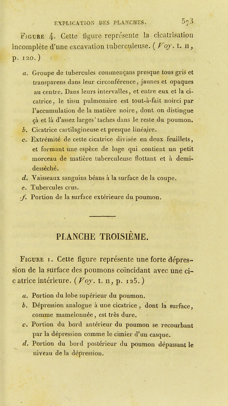 Figure 4. Celle liguro reprc'seiile la cicalrisatioii incomplèle d'une excavalioii luberouleiise. ( Foj. t. 11, p. 120. ) / a. Groupe de tubercules conimençans presque tous gris et transparens dans leur circonférence, jaunes et opaques au centre. Dans leurs intervalles, et entre eux et la ci- catrice, le tissu pulmonaire est tout-à-fait noirci par l'accumulation de la matière noire, dont on distingue çà et là d'assez larges ' taches dans le reste du poumon. b. Cicatrice cartilagineuse et presque linéa^ire. c. Extrémité de cette cicatrice divisée en deux feuillets, et formant une espèce de loge qui contient un petit morceau de matière tuberculeuse flottant et à demi- desséché. d. Vaisseaux sanguins béans à la surface de la coupe. e. Tubercules crus. if. Portion de la surface extérieure du poumon. PLANCHE TROISIÈME. Figure i . Celte figure représente une forte dépres- sion de la surface des poumons coïncidant avec une ci- c atrice intérieure. ( Foj. t. ii^ p. i25. ) a. Portion du lobe supérieur du poumon. b. Dépression analogue à une cicatrice , dont la surface, comme mamelonnée, est très dure. c. Portion du bord antérieur du poumon se recourbant par la dépression comme le cimier d'un casque. d. Portion du bord postéi'ieur du poumon dépassant le niveau delà dépression.