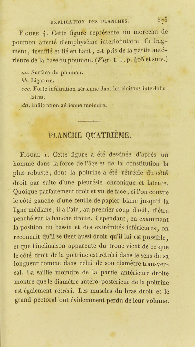 Figure 4. Cette figure représente un morceau de poumon affecté d'emphysème inlerlobulaire. Ce frag- ment, insufflé et lié en haut, est pris de la partie anté- rieure de la base du poumon. (Foj. t. 1, p. 4o5 et suiv.) aa. Surface du poumon. bh. Ligature. ccc. Forte infiiltralion aérienne dans les cloisons intcrlobu- 1aires. dd. Infiltration aérienne moindre. PLANCHE QUATRIÈME. Figure i . Cette figure a été dessinée d'après un homme dans la force de l'âge et de la constitution la plus robuste, dont la poitrine a été rétrécie du côté droit par suite d'une pleurésie chronique et latente. Quoique parfaitement droit et vu de face, si l'on couvre le côté gauche d'une feuille de papier blanc jusqu'à la ligne médiane, il a l'air, au premier coup d'œil, d'être penché sur la hanche droite. Cependant, en examinant la position du bassin et des extrémités inférieures, on reconnaît qu'il se tient aussi droit qu'il lui est possible, et que l'inclinaison apparente du tronc vient de ce que le côté droit de la poitrine est rétréci dans le sens de sa longueur comme dans celui de son diamètre transver- sal. La saillie moindre de la partie antérieure droite montre que le diamètre antéro-postérieur de la poitrine est également rétréci. Les muscles du bras droit et le grand pectoral ont évidemment perdu de leur volume.