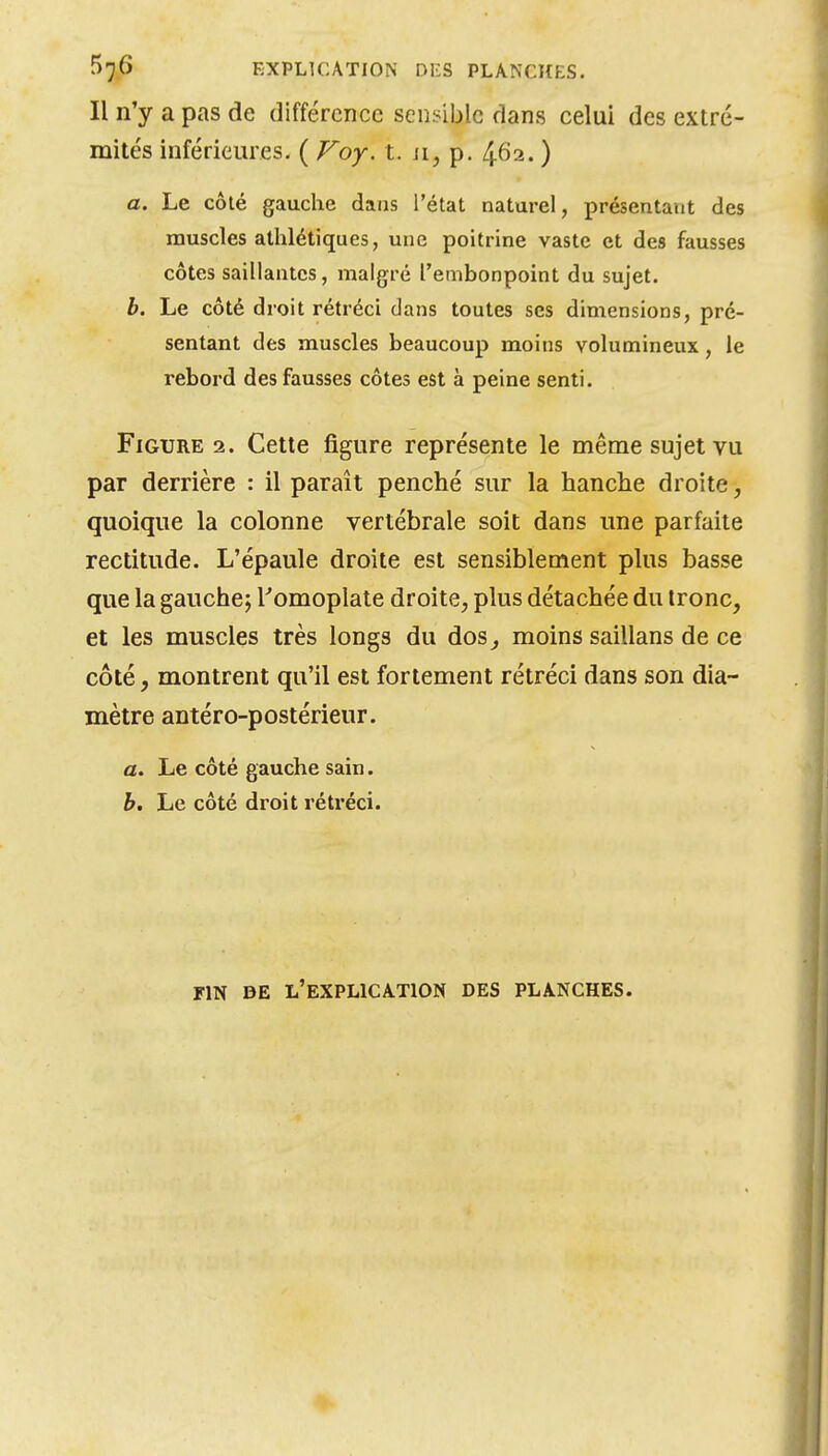 Il n'y a pas de différence sensible dans celui des extré- mités inférieures. ( Voy. t. ii, p. 462. ) a. Le côté gauche dans l'état naturel, présentant des muscles athlétiques, une poitrine vaste et des fausses côtes saillantes, malgré l'embonpoint du sujet. h. Le côté droit rétréci dans toutes ses dimensions, pré- sentant des muscles beaucoup moins volumineux, le rebord des fausses côtes est à peine senti. Figures. Cette figure représente le même sujet vu par derrière : il paraît penché sur la hanche droite, quoique la colonne vertébrale soit dans une parfaite rectitude. L'épaule droite est sensiblement plus basse que la gauche; Tomoplate droite, plus détachée du tronc, et les muscles très longs du dos^ moins saillans de ce côté, montrent qu'il est fortement rétréci dans son dia- mètre antéro-postérieur. a. Le côté gauche sain. h. Le côté droit rétréci. FIN DE l'explication DES PLANCHES.