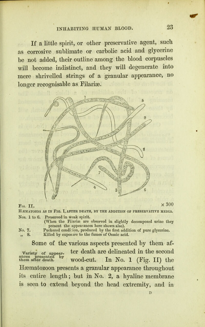 If a little spirif., or other preservative agent, such as corrosive sublimate or carbolic acid and glycerine be not added, their outline among the blood corpuscles will become indistinct, and they will degenerate into mere shrivelled strings of a granular appearance, no longer recognisable as Pilarise. Fia. II. X 300 H^MATOZOA AS IN FiG. I, AFTER DEATH, BY THE ADDITION OF PEESEEVATIVE MEDIA. Nos. 1 to 6. Preserved in weak spirit. (When the Filarise are observed in slightly decomposed urine they pi'esent the appearances here shown also). No. 7. Puckered condi bion, produced by the first addition of pure glycerine. „ 8. Killed by expos are to the fumes of Osmic acid. Some of the various aspects presented by them af- ter death are delineated in the second wood-cut. In No. 1 (Fig. II) the Hsematozoon presents a granular appearance throughout its entire length; but in No. 2, a hyaline membrane is seen to extend beyond the head extremity, and in Variety of appear- ances presented by them after death..