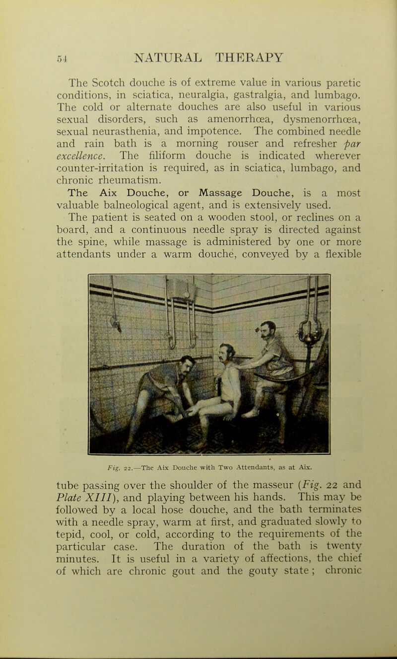 The Scotch douche is of extreme value in various paretic conditions, in sciatica, neuralgia, gastralgia, and lumbago. The cold or alternate douches are also useful in various sexual disorders, such as amenorrhcea, dysmenorrhoea, sexual neurasthenia, and impotence. The combined needle and rain bath is a morning rouser and refresher par excellence. The filiform douche is indicated wherever counter-irritation is required, as in sciatica, lumbago, and chronic rheumatism. The Aix Douche, or Massage Douche, is a most valuable balneological agent, and is extensively used. The patient is seated on a wooden stool, or reclines on a board, and a continuous needle spray is directed against the spine, while massage is administered by one or more attendants under a warm douche, conveyed by a flexible Fig. 22.—The Aix Douche with Two Attendants, as at Aix. tube passing over the shoulder of the masseur {Fig. 22 and Plate XIII), and playing between his hands. This may be followed by a local hose douche, and the bath terminates with a needle spray, warm at first, and graduated slowly to tepid, cool, or cold, according to the requirements of the particular case. The duration of the bath is twenty minutes. It is useful in a variety of affections, the chief of which are chronic gout and the gouty state ; chronic