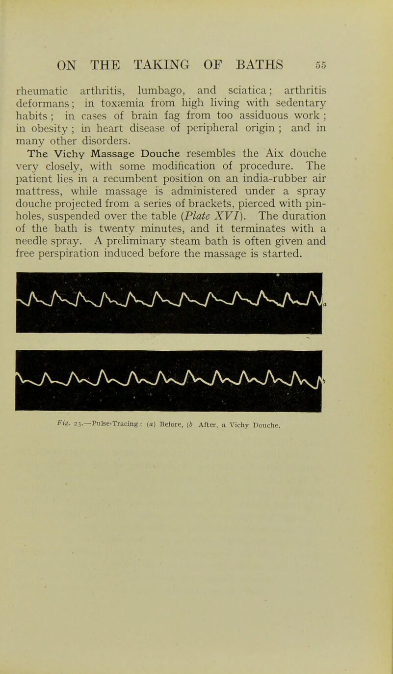 rheumatic arthritis, himbago, and sciatica; arthritis deformans; in toxaemia from high hving with sedentary habits ; in cases of brain fag from too assiduous work ; in obesity ; in heart disease of peripheral origin ; and in many other disorders. The Vichy Massage Douche resembles the Aix douche very closely, with some modification of procedure. The patient lies in a recumbent position on an india-rubber air mattress, while massage is administered under a spray douche projected from a series of brackets, pierced with pin- holes, suspended over the table {Plate XVI). The duration of the bath is twenty minutes, and it terminates with a needle spray. A preliminary steam bath is often given and free perspiration induced before the massage is started. Fig. 23.—Pulse-Tracing : (a) Belore, (b After, a Vichy Douche.