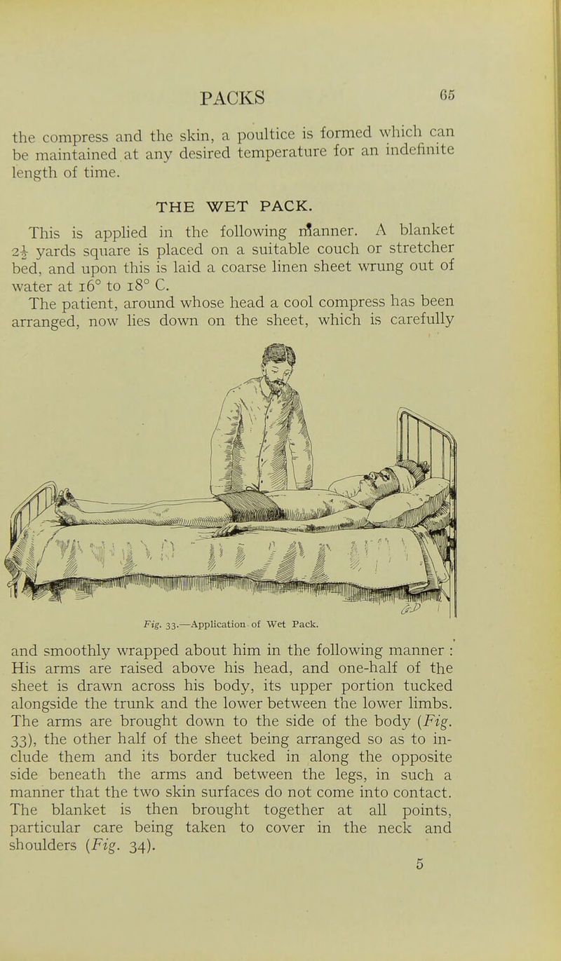 the compress and the skin, a poultice is formed which can be maintained at any desired temperature for an indefinite length of time. THE WET PACK. This is applied in the following n?anner. A blanket 2| yards square is placed on a suitable couch or stretcher bed, and upon this is laid a coarse linen sheet wrung out of water at i6° to i8° C. The patient, around whose head a cool compress has been arranged, now lies down on the sheet, which is carefully Pig- 33-—Application of Wet Pack. and smoothly wrapped about him in the following manner : His arms are raised above his head, and one-half of the sheet is drawn across his body, its upper portion tucked alongside the trunk and the lower between the lower limbs. The arms are brought down to the side of the body {Fig. 33), the other half of the sheet being arranged so as to in- clude them and its border tucked in along the opposite side beneath the arms and between the legs, in such a manner that the two skin surfaces do not come into contact. The blanket is then brought together at all points, particular care being taken to cover in the neck and shoulders {Fig. 34). 5