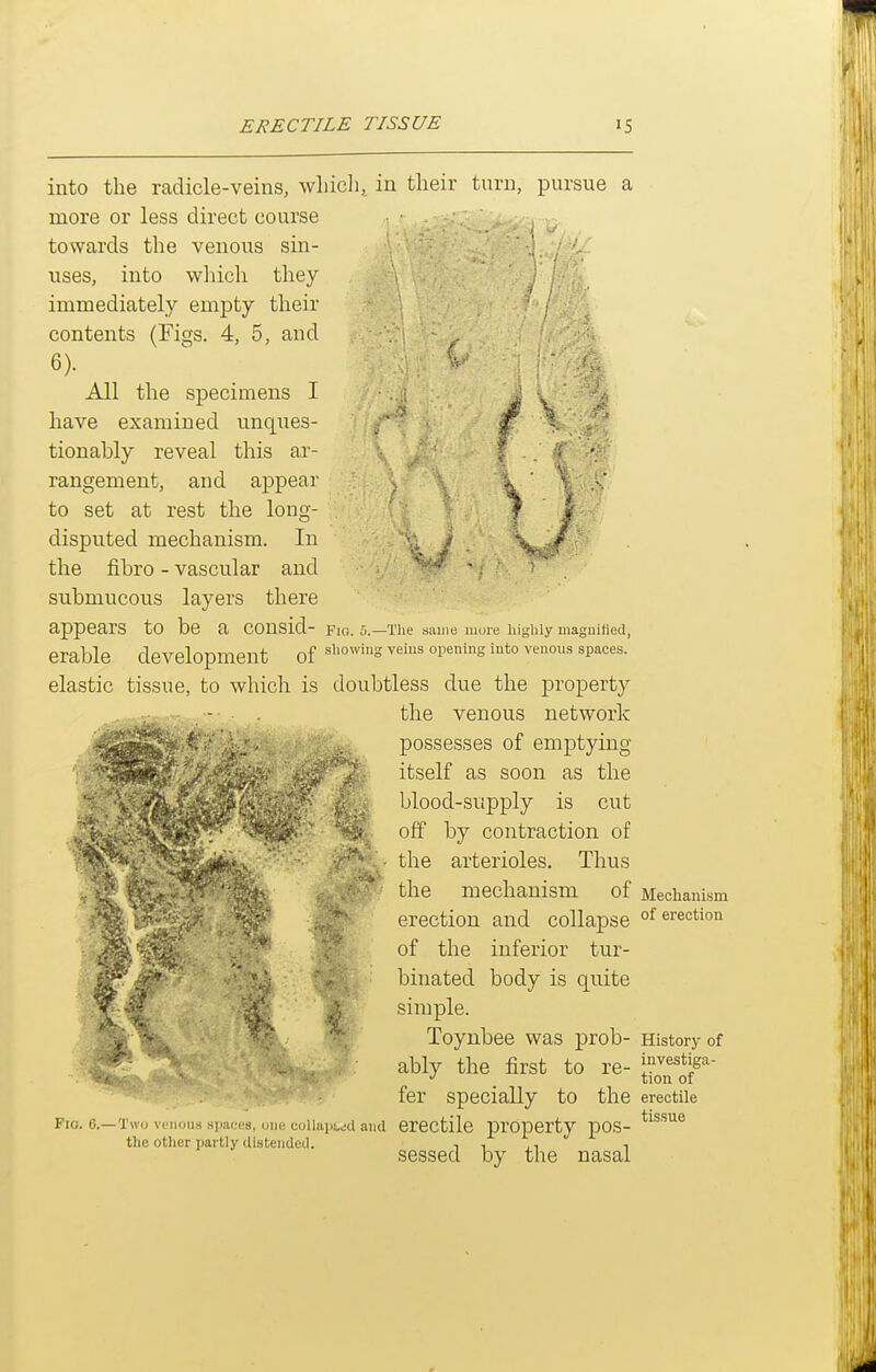 into the radicle-veins, wliicli, in their turn, pursue a more or less direct course towards the venous sin- uses, into wliich they immediately empty their contents (Fij^s. 4, 5, and 6). ^ All the specimens I have examined unques- tionably reveal this ar- rangement, and appear to set at rest the long- disputed mechanism. In the fibro - vascular and ■ submucous layers there appears to be a COnsid- Fiq. u.—The .same more liighly magnified, erable development of ^l-owing veins opening into venous spaces. elastic tissue, to which is doubtless due the property the venous network possesses of emptying itself as soon as the blood-supply is cut off by contraction of the arterioles. Thus the mechanism of erection and collapse of the inferior tur- binated body is quite simple. Toynbee was prob- ably the first to re- fer specially to the Meclianism of erection Fig. O.— TwM venous .spaces, uiK! collaiii,<id and erCCtilc property pOS- the other partly distended. History of investiga- tion of erectile tis.sue sessed by the nasal