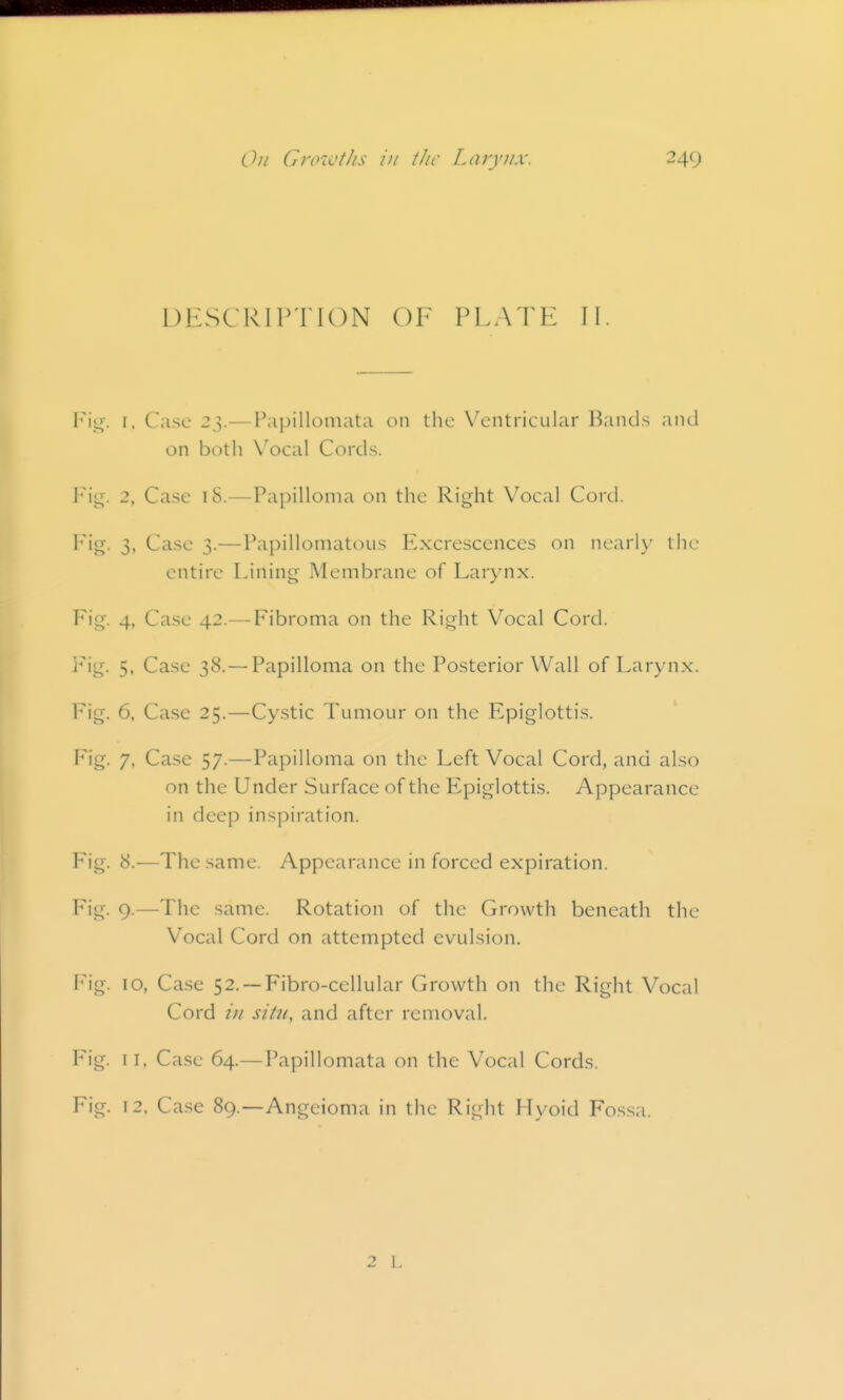 On GroK'f/is ill tJic Larynx. 249 UESCRIP'JION OF PLATE II. VVg. I, Case 23.—Papillomata on the Ventricular Bands and on both \'ocal Cords. Vv^. 2, Case 18.—Papilloma on the Right Vocal Cord. Fig. 3, Case 3.—Papillomatous Excrescences on nearly the entire Lining Membrane of Larynx. Fig. 4, Case 42.— Fibroma on the Right Vocal Cord. Fig. 5. Case 38. — Papilloma on the Posterior Wall of Larynx. Fig. 6, Case 25.—Cystic Tumour on the Epiglottis. Fig. 7, Case 57.—Papilloma on the Left Vocal Cord, and also on the Under Surface of the Epiglottis. Appearance in deep inspiration. Fig. 8.—The same. Appearance in forced expiration. Fig. 9.—The same. Rotation of the Growth beneath the Vocal Cord on attempted evulsion. V\g. 10, Case 52. —Fibro-cellular Growth on the Right Vocal Cord /;/ situ, and after removal. Fig. 11. Case 64.— Papillomata on the Vocal Cords. Fig. T2, Case 89.—Angeioma in the Right Myoid Fossa.