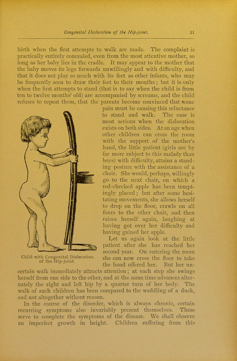 birth when the first attempts to walk are made. The complaint is practically entirely concealed, even from the most attentive mother, so long as her baby lies in the cradle. It may appear to the mother that the baby moves its legs forwards unwillingly and with difficulty, and that it does not play so much with its feet as other infants, who may be frequently seen to draw their feet to their mouths ; but it is only when the first attempts to stand (that is to say when the child is from ten to twelve months' old) are accompanied by screams, and the child refuses to repeat them, that the parents become convinced that some pain must be causing this reluctance to stand and walk. The case is most serious when the dislocation exists on both sides. At an age when other children can cross the room with the support of the mother's hand, the little patient (girls are by far more subject to this malady than boys) with difficulty, attains a stand- ing posture with the assistance of a chair. She would, perhaps, willingly go to the next chair, on which a red-cheeked apple has been tempt- ingly placed; but after some hesi- tating movements, she allows herself to drop on the floor, crawls on all fours to the other chair, and then raises herself again, laughing at having got over her difficulty and having gained her apple. lyet us again look at the little patient after she has reached her second year. On entering the room Child with Congenital Dislocation can now cross the floor to take of the Hip-jomt. . „ ^ , t-. i the hand offered her. But her un- certain walk immediately attracts attention; at each step she swings herself from one side to the other, and at the same time advances alter- nately the right and left hip by a quarter turn of her body. The walk of such children has been compared to the waddling of a duck, and not altogether without reason. In the course of the disorder, which is always chronic, certain recurring symptoms also invariably present themselves. These serve to complete the symptoms of the disease. We shall observe an imperfect growth in height. Children suffering from this