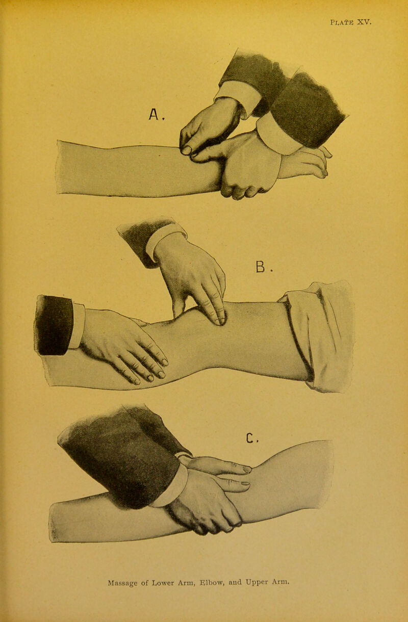 Pl.AtE XV. Massage of Lower Arm, Elbow, and Upper Arm.