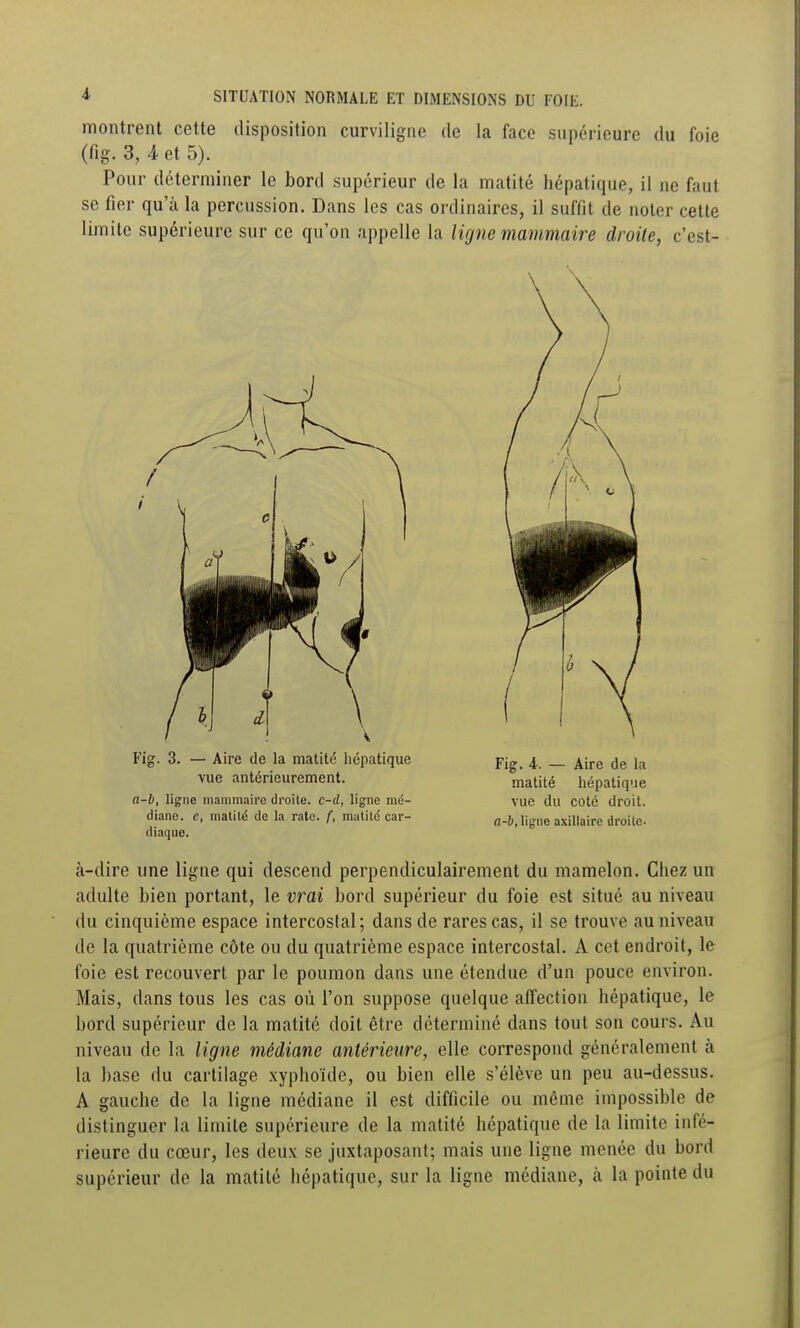 montrent cette disposition curviligne de la face supérieure du foie (fig. 3, 4 et 5). Pour déterminer le bord supérieur de la matité hépatique, il ne faut se fier qu'à la percussion. Dans les cas ordinaires, il suffit de noter cette limite supérieure sur ce qu'on appelle la ligne mammaire droite, c'est- a-b, ligne mammaire droite, c-rf, ligne mé- vue du COté droit, diane. c, matité de la rate, f, matitc car- n-6, ligne axillaire droite diaque. à-dire une ligne qui descend perpendiculairement du mamelon. Chez un adulte bien portant, le vrai bord supérieur du foie est situé au niveau du cinquième espace intercostal; dans de rares cas, il se trouve au niveau de la quatrième côte ou du quatrième espace intercostal. A cet endroit, le foie est recouvert par le poumon dans une étendue d'un pouce environ. Mais, dans tous les cas où l'on suppose quelque affection hépatique, le bord supérieur de la matité doit être déterminé dans tout son cours. Au niveau de la ligne médiane antérieure, elle correspond généralement à la base du cartilage xyphoïde, ou bien elle s'élève un peu au-dessus. A gauche de la ligne médiane il est difficile ou même impossible de distinguer la limite supérieure de la matité hépatique de la limite infé- rieure du cœur, les deux se juxtaposant; mais une ligne menée du bord supérieur de la matité hépatique, sur la ligne médiane, à la pointe du