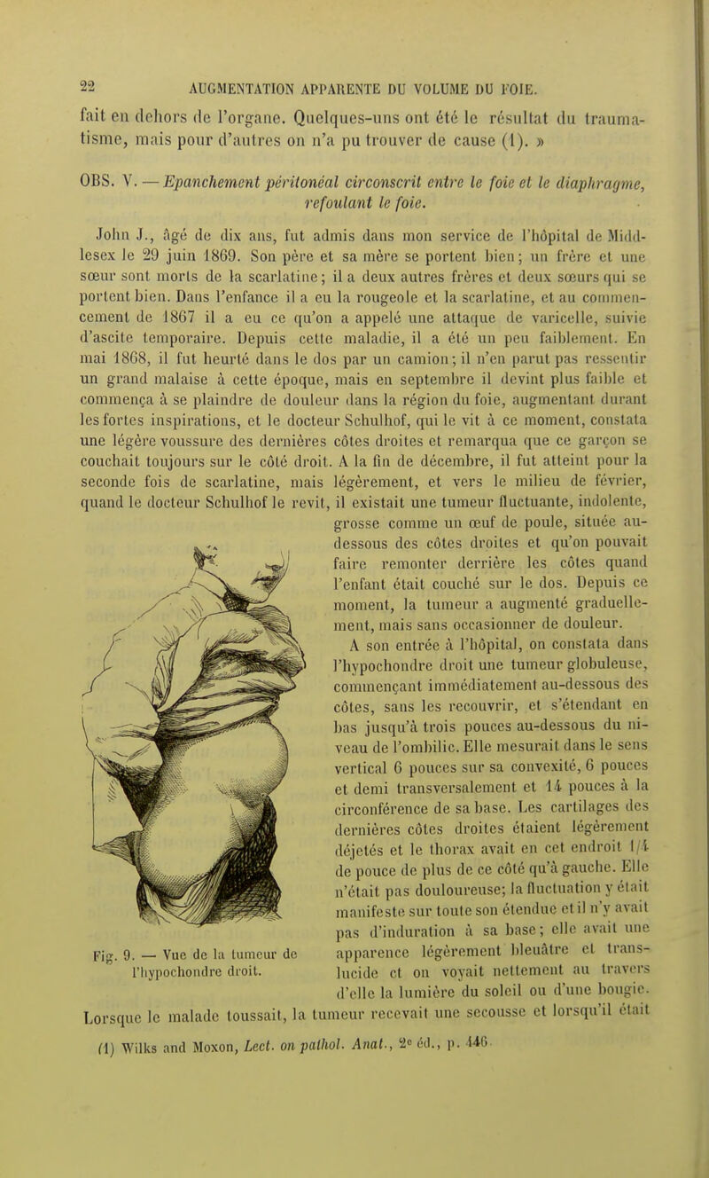 fait eu dehors de l'organe. Quelques-uns ont été le résultat du trauma- tisme, mais pour d'autres on n'a pu trouver de cause (1). » OBS. V.—Epanchement péritonéal circonscrit entre le foie et le diaphragme, refoulant le foie. John J., âgé de dix ans, fut admis dans mon service de l'hôpital de Midd- lesex le 29 juin 1869. Son père et sa mère se portent hien; un frère et une sœur sont morts de la scarlatine; il a deux autres frères et deux sœurs qui se portent bien. Dans l'enfance il a eu la rougeole et la scarlatine, et au commen- cement de 1867 il a eu ce qu'on a appelé une attaque de varicelle, suivie d'ascite temporaire. Depuis cette maladie, il a été un peu faiblement. En mai 1868, il fut heurté dans le dos par un camion; il n'en parut pas ressciUir un grand malaise à cette époque, mais en septembre il devint plus faible et commença à se plaindre de douleur dans la région du foie, augmentant durant les fortes inspirations, et le docteur Schulhof, qui le vit à ce moment, constata une légère voussure des dernières côtes droites et remarqua que ce garçon se couchait toujours sur le côté droit. A la fin de décembre, il fut atteint pour la seconde fois de scarlatine, mais légèrement, et vers le milieu de février, quand le docteur Schulhof le revit, il existait une tumeur fluctuante, indolente, grosse comme un œuf de poule, située au- dessous des côtes droites et qu'on pouvait faire remonter derrière les côtes quand l'enfant était couché sur le dos. Depuis ce moment, la tumeur a augmenté graduelle- ment, mais sans occasionner de douleur. A son entrée à l'hôpital, on constata dans l'hypochondre droit une tumeur globuleuse, commençant immédiatement au-dessous des côtes, sans les recouvrir, et s'étendant en bas jusqu'à trois pouces au-dessous du ni- veau de l'ombilic. Elle mesurait dans le sens vertical 6 pouces sur sa convexité, 6 pouces et demi transversalement et 14 pouces à la circonférence de sa base. Les cartilages des dernières côtes droites étaient légèrement déjetés et le thorax avait en cet endroit l/i de pouce de plus de ce côté qu'à gauche. Elle n'était pas douloureuse; la fluctuation y était manifeste sur toute son étendue et il n'y avait pas d'induration à sa base; elle avait une apparence légèrement bleuâtre et trans- lucide et on voyait nettement au travers d'elle la lumière du soleil ou d'une bougie. Lorsque le malade toussait, la tumeur recevait une secousse et lorsqu'il était n) Wilks and Moxon, Lecl. on palhol. Anat., 2 étl., p. 146 pig. 9. — Vue de l;i tumeur de riiypochoiulre droit.