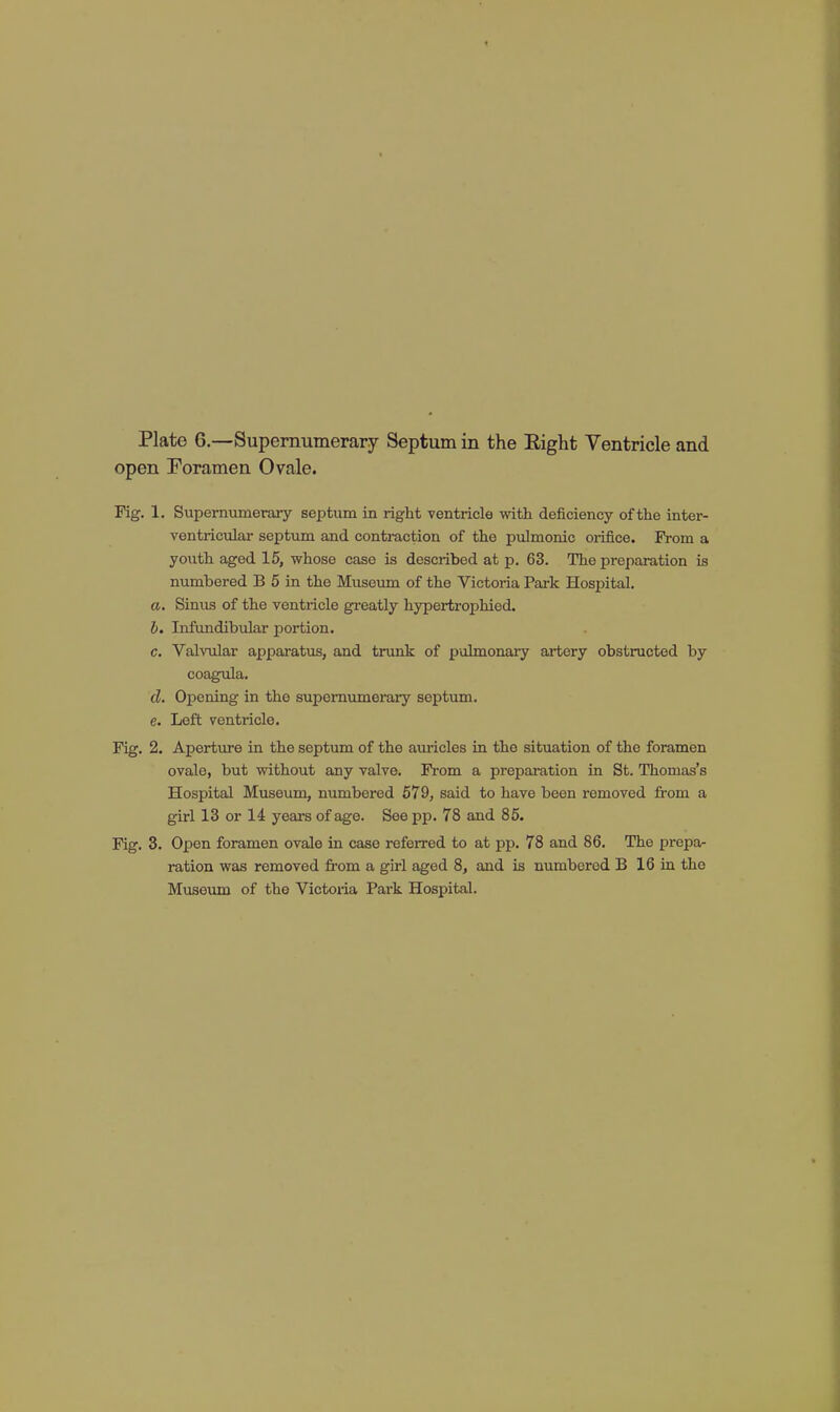 Plate 6.—Supernumerary Septum in the Eight Ventricle and open Foramen Ovale. Fig. 1. Supernumerary septum in right ventricle with deficiency of the inter- ventricular septum and contraction of the pulmonic orifice. From a youth aged 15, whose case is described at p. 63. The preparation is numbered B 5 in the Museum of the Victoria Park Hospital. a. Sinus of the ventricle greatly hypertrophied. h. Infundibular jjortion. c. Valvular apparatus, and trunk of pulmonary artery obstructed by coagula. d. Opening in the supernumerary septum. e. Left ventricle. Fig. 2. Aperture in the septum of the auricles in the situation of the foramen ovale, but without any valve. From a preparation in St. Thomas's Hospital Museum, numbered 679, said to have been removed from a girl 13 or 14 years of age. See pp. 78 and 85. Fig. 3. Open foramen ovale in case referred to at pp. 78 and 86. The prepa- ration was removed from a girl aged 8, and is numbered B 16 in the Museum of the Victoria Park Hospital.