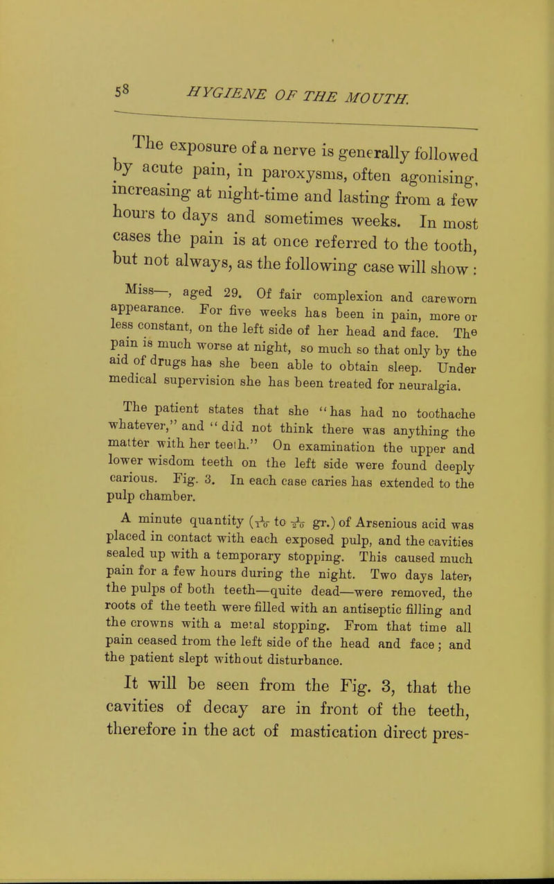 The exposure of a nerve is generally followed by acute pain, in paroxysms, often agonising increasing at night-time and lasting from a few hours to days and sometimes weeks. In most cases the pain is at once referred to the tooth, but not always, as the following case will show! Miss-, aged 29. Of fair complexion and careworn appearance. For five weeks has been in pain, more or less constant, on the left side of her head and face. The pain 18 much worse at night, so much so that only by the aid of drugs has she been able to obtain sleep. Under medical supervision she has been treated for neuralgia. The patient states that she has had no toothache whatever, and did not think there was anything the matter with her teeih. On examination the upper and lower wisdom teeth on the left side were found deeply carious. Fig. 3. In each case caries has extended to the pulp chamber. A minute quantity (to ^ gr.) of Arsenious acid was placed in contact with each exposed pulp, and the cavities sealed up with a temporary stopping. This caused much pain for a few hours during the night. Two days later, the pulps of both teeth—quite dead—were removed, the roots of the teeth were filled with an antiseptic filling and the crowns with a meral stopping. From that time all pain ceased from the left side of the head and face ; and the patient slept without disturbance. It will be seen from the Fig. 3, that the cavities of decay are in front of the teeth, therefore in the act of mastication direct pres-