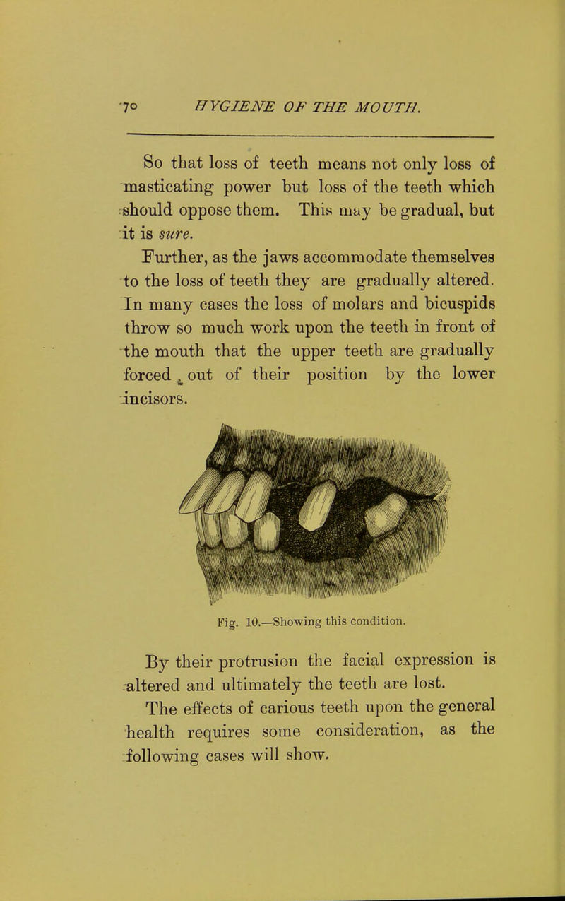 So that loss of teeth means not only loss of masticating power but loss of the teeth which should oppose them. This may be gradual, but it is mre. Further, as the jaws accommodate themselves to the loss of teeth they are gradually altered. In many cases the loss of molars and bicuspids throw so much work upon the teeth in front of the mouth that the upper teeth are gradually forced ^ out of their position by the lower incisors. Fig. 10.—Showing this condition. By their protrusion the facial expression is -altered and ultimately the teeth are lost. The effects of carious teeth upon the general health requires some consideration, as the following cases will show.
