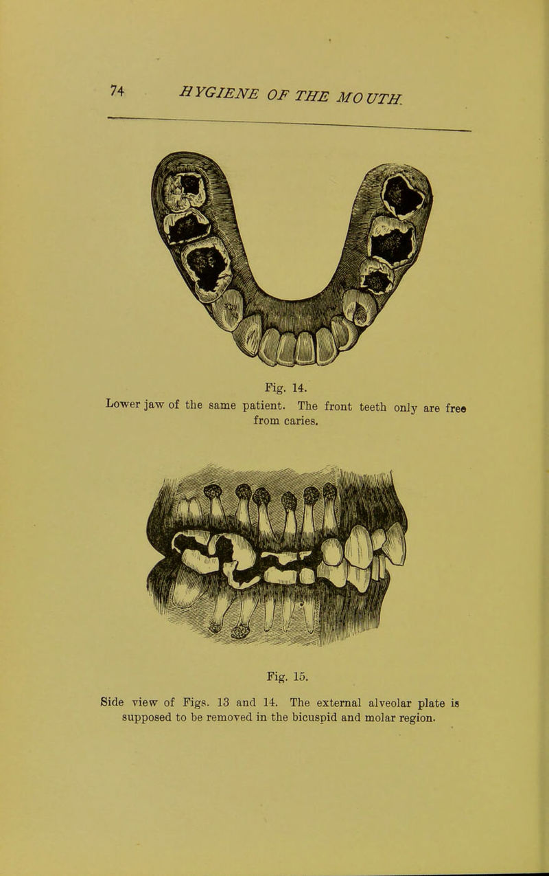 Fig. 16. Side view of Figs. 13 and 14. The external alveolar plate is supposed to be removed in the bicuspid and molar region.