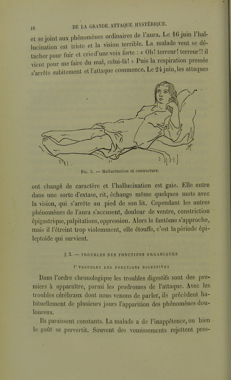 et se joint aux phénomènes ordinaires de 1 aura. Le 16 juin 1 hal- lucination est triste et la vision terrible. La malade veut se dé- tacher pour fuir et cried'unevoix forte : « Oh! terreur! terreur!! il vient pour me faire du mal, celui-là! » Puis la respiration pressée s'arrête subitement et l'attaque commence. Le 24 juin, les attaques Fig. 5. — Hallucination et contracture. ont changé de caractère et l'hallucination est gaie. Elle entre dans une sorte d'extase, rit, échange même quelques mots avec la vision, qui s'arrête au pied de son lit. Cependant les autres phénomènes de l'aura s'accusent, douleur de ventre, constriction épigastrique, palpitations, oppression. Alors le fantôme s'approche, mais il l'étreint trop violemment, elle étouffe, c'est la période épi- leptoïde qui survient. § 2. — TROUBLES DES FONCTIONS ORGANIQUES 10THOUBLES DES FONCTIONS DIGESTIVES Dans l'ordre chronologique les troubles digestifs sont des pre- miers à apparaître, parmi les prodromes de l'attaque. Avec les troubles cérébraux dont nous venons de parler, ils précèdent ha- bituellement de plusieurs jours l'apparition des phénomènes dou- loureux. Ils paraissent constants. La malade a de Finappétencc, ou bien le goût se pervertit. Souvent des vomissements rejettent près-