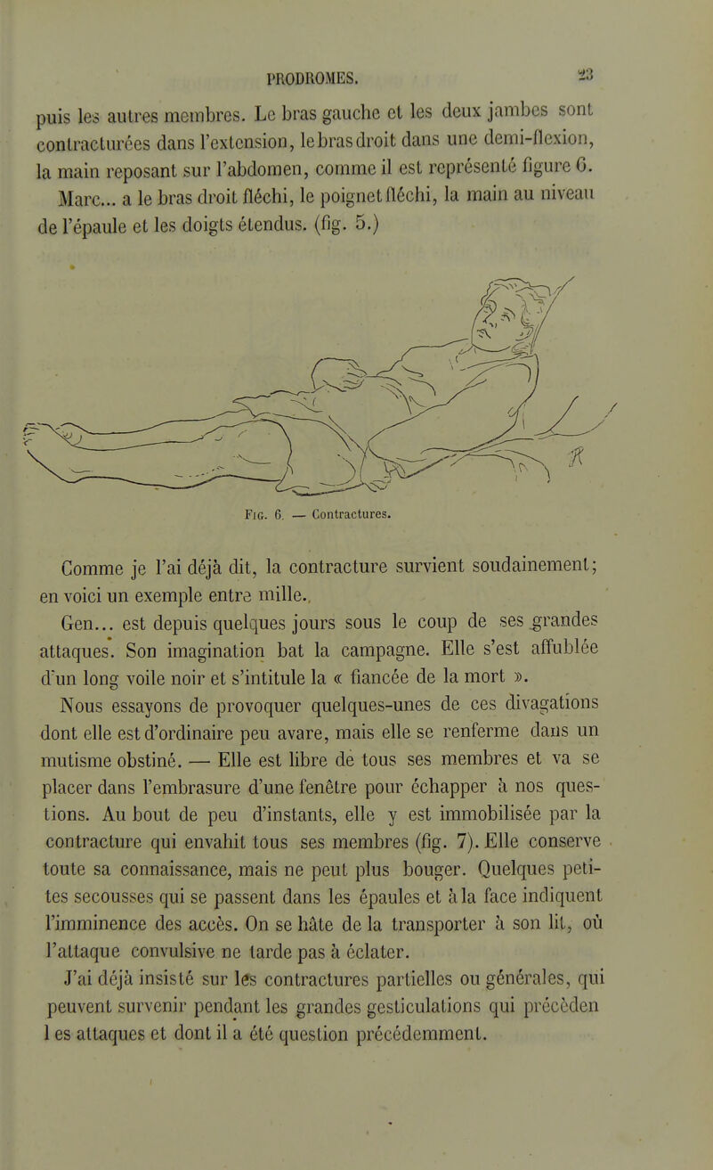 puis les autres membres. Le bras gauche et les deux jambes sont conlracturées dans l'extension, le bras droit dans une demi-flexion, la main reposant sur l'abdomen, comme il est représenté figure G. Marc... a le bras droit fléchi, le poignet fléchi, la main au niveau de l'épaule et les doigts étendus, (fig. 5.) Fig. 6. — Contractures. Comme je l'ai déjà dit, la contracture survient soudainement; en voici un exemple entre mille., Gen... est depuis quelques jours sous le coup de ses .grandes attaques*. Son imagination bat la campagne. Elle s'est affublée d'un long voile noir et s'intitule la « fiancée de la mort ». Nous essayons de provoquer quelques-unes de ces divagations dont elle est d'ordinaire peu avare, mais elle se renferme dans un mutisme obstiné. — Elle est libre de tous ses membres et va se placer dans l'embrasure d'une fenêtre pour échapper à nos ques- tions. Au bout de peu d'instants, elle y est immobilisée par la contracture qui envahit tous ses membres (fig. 7). Elle conserve toute sa connaissance, mais ne peut plus bouger. Quelques peti- tes secousses qui se passent dans les épaules et à la face indiquent l'imminence des accès. On se hâte de la transporter à son lit, où l'attaque convulsive ne tarde pas à éclater. J'ai déjà insisté sur les contractures partielles ou générales, qui peuvent survenir pendant les grandes gesticulations qui précèden 1 es attaques et dont il a été question précédemment.