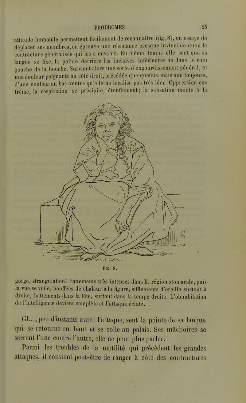 attitude immobile permettent facilement de reconnaître (fig. 8), on essaye de déplacer ses membres, on éprouve une résistance presque invincible duc à la contracture généralisée qui les a envahis. En même temps elle sent que sa langue se fixe, la pointe derrière les incisives inférieures ou dans le coin gauche de la bouche. Survient alors une sorte d'engourdissement général, et une douleur poignante au côté droit, précédée quelquefois, mais non toujours, d'une douleur au bas-ventre qu'elle ne localise pas très bien. Oppression ex- trême, la respiration se précipite, étouffement; la sensation monte à la Fig. 8. gorge, strangulation. Battements très intenses dans la région stomacale, puis la vue se voile, bouffées de chaleur à la figure, sifflements d'oreille surtout à droite, battements dans la tête, surtout dans la tempe droite. L'obnubilation de l'intelligence devient complète et l'attaque éclate. Gl..., peu d'instants avant l'attaque, sent la pointe de sa langue qui se retourne en haut et se colle au palais. Ses mâchoires se serrent l'une contre l'autre, elle ne peut plus parler. Parmi les troubles de la motilité qui précèdent les grandes attaques, il convient peut-être de ranger à côté des contractures